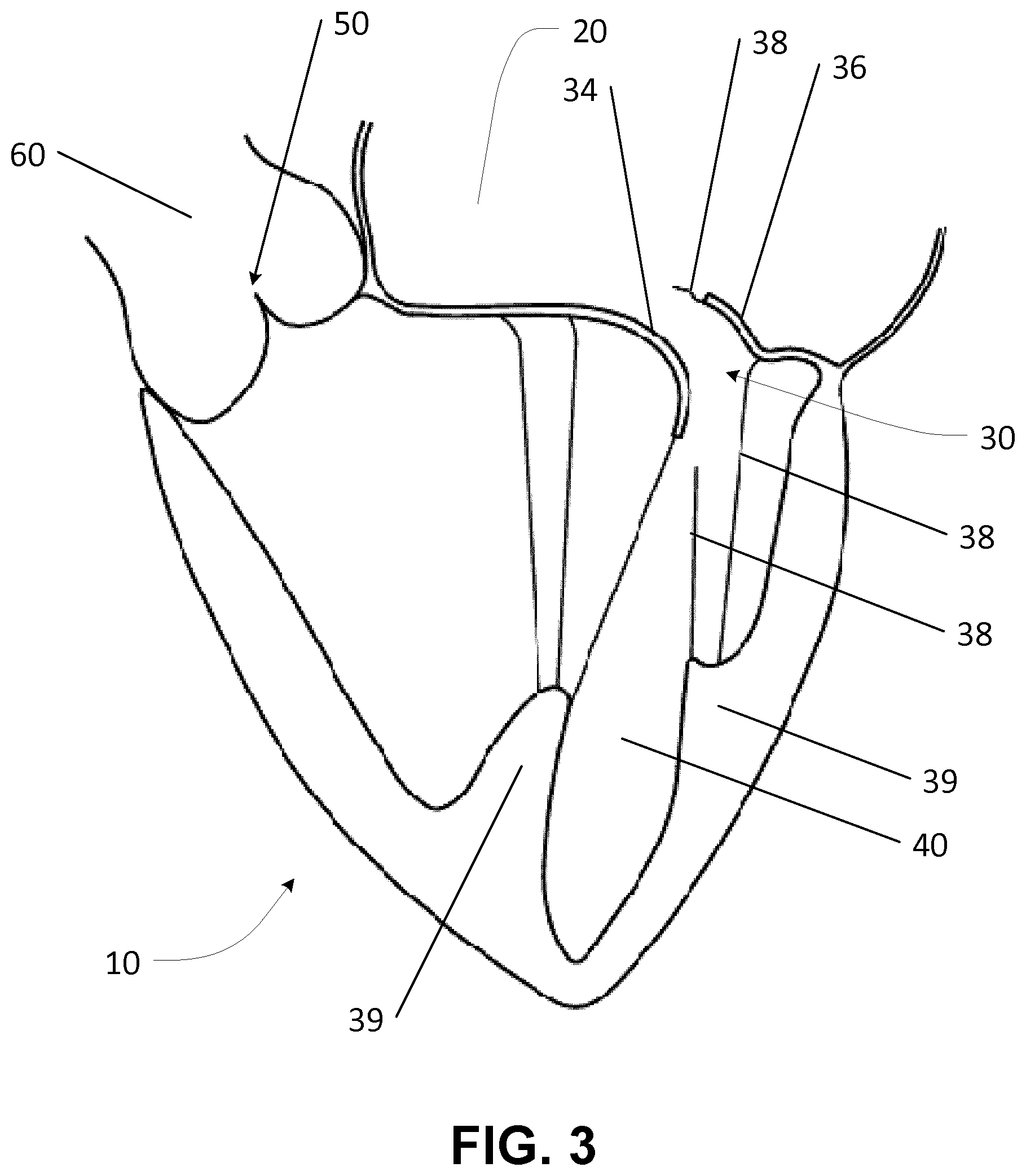Patent US12569342 Figure 3 – Apparatus and methods for clamping a mitral valve