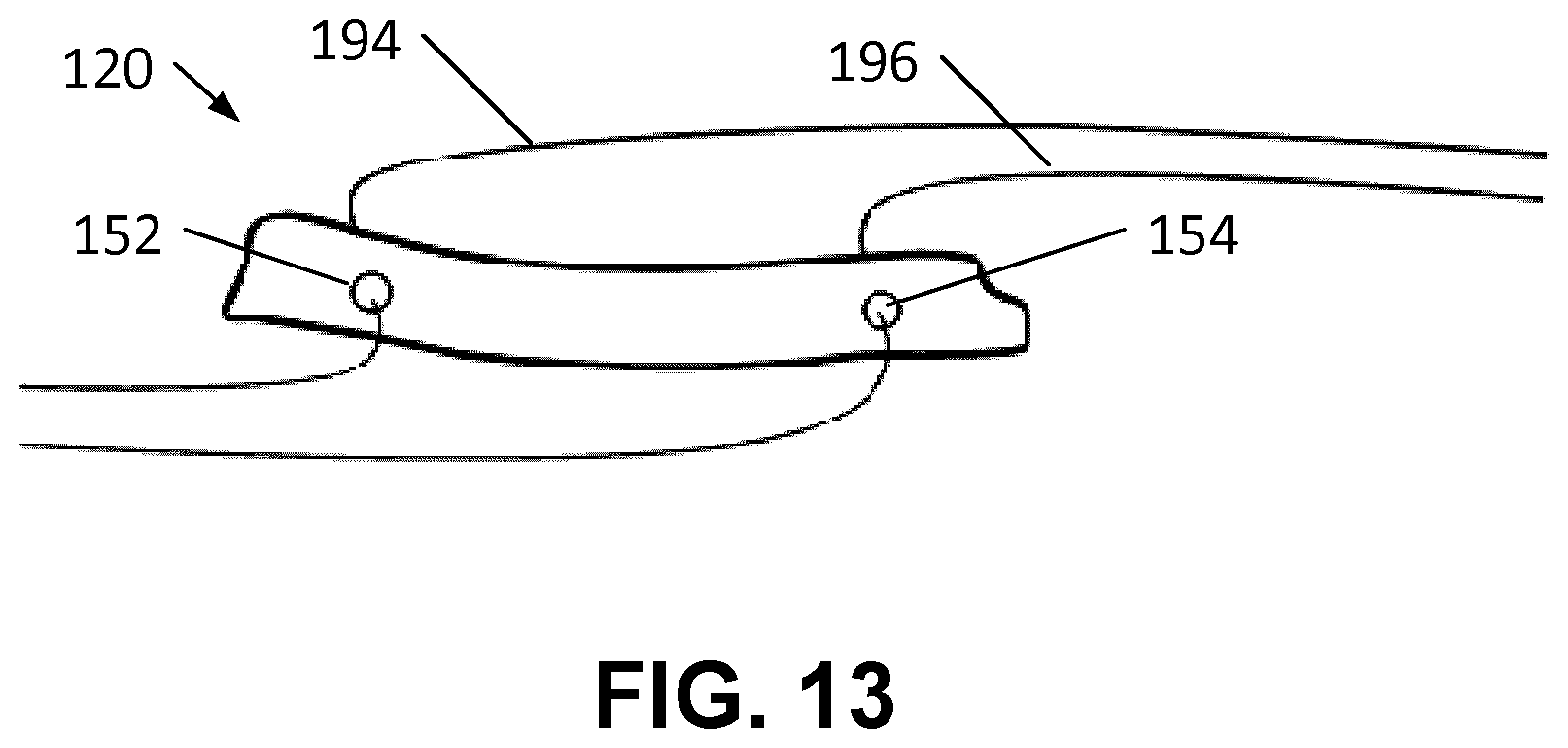 Patent US12569342 Figure 10 – Apparatus and methods for clamping a mitral valve