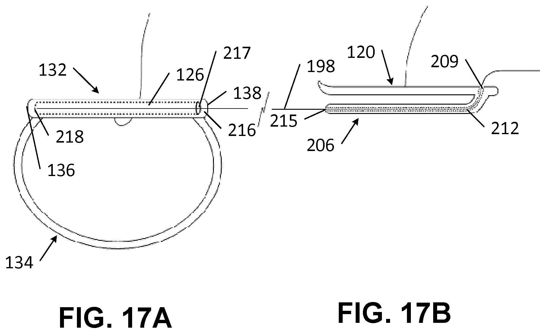 Patent US12569342 Figure 14 – Apparatus and methods for clamping a mitral valve