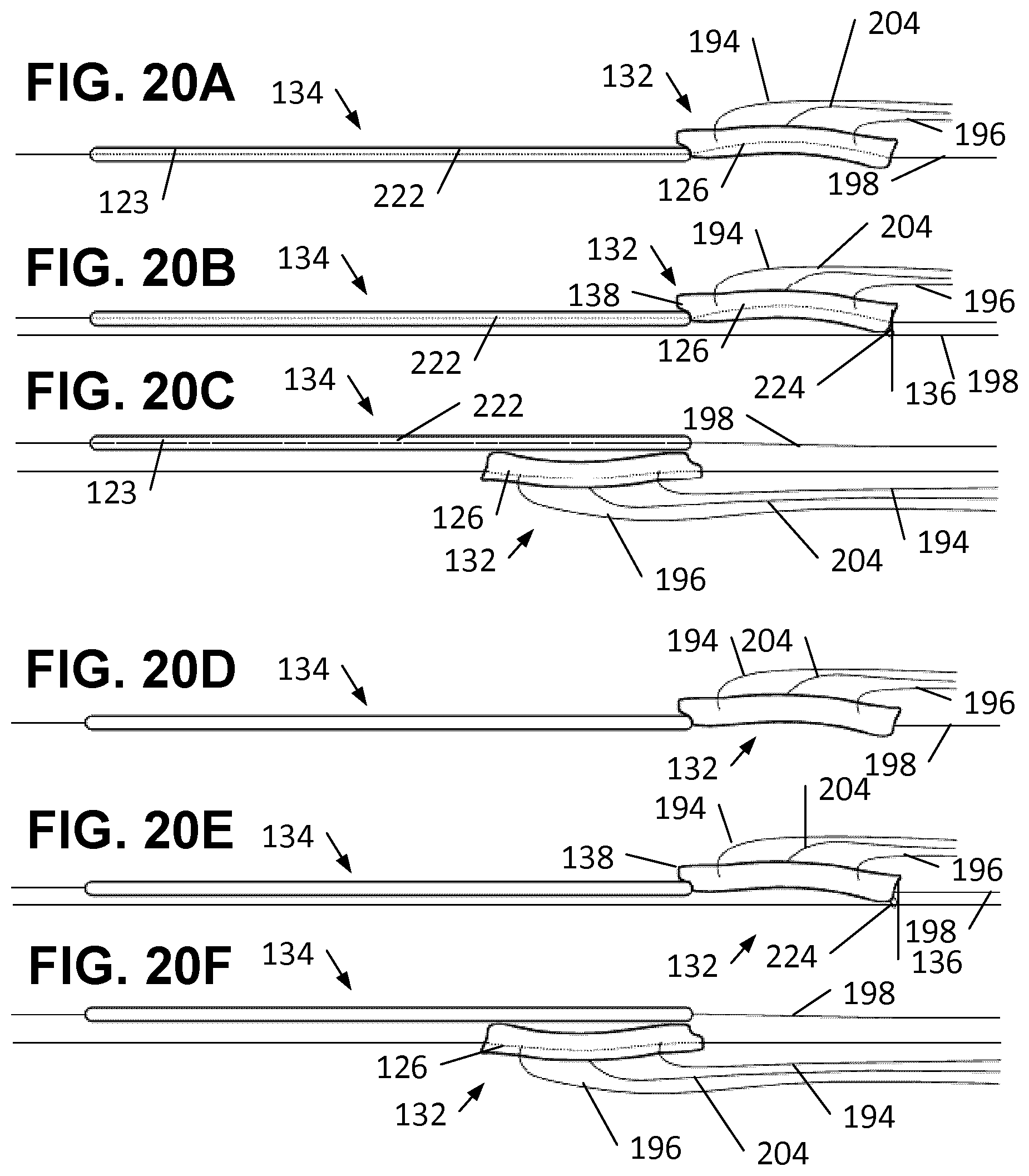 Patent US12569342 Figure 17 – Apparatus and methods for clamping a mitral valve