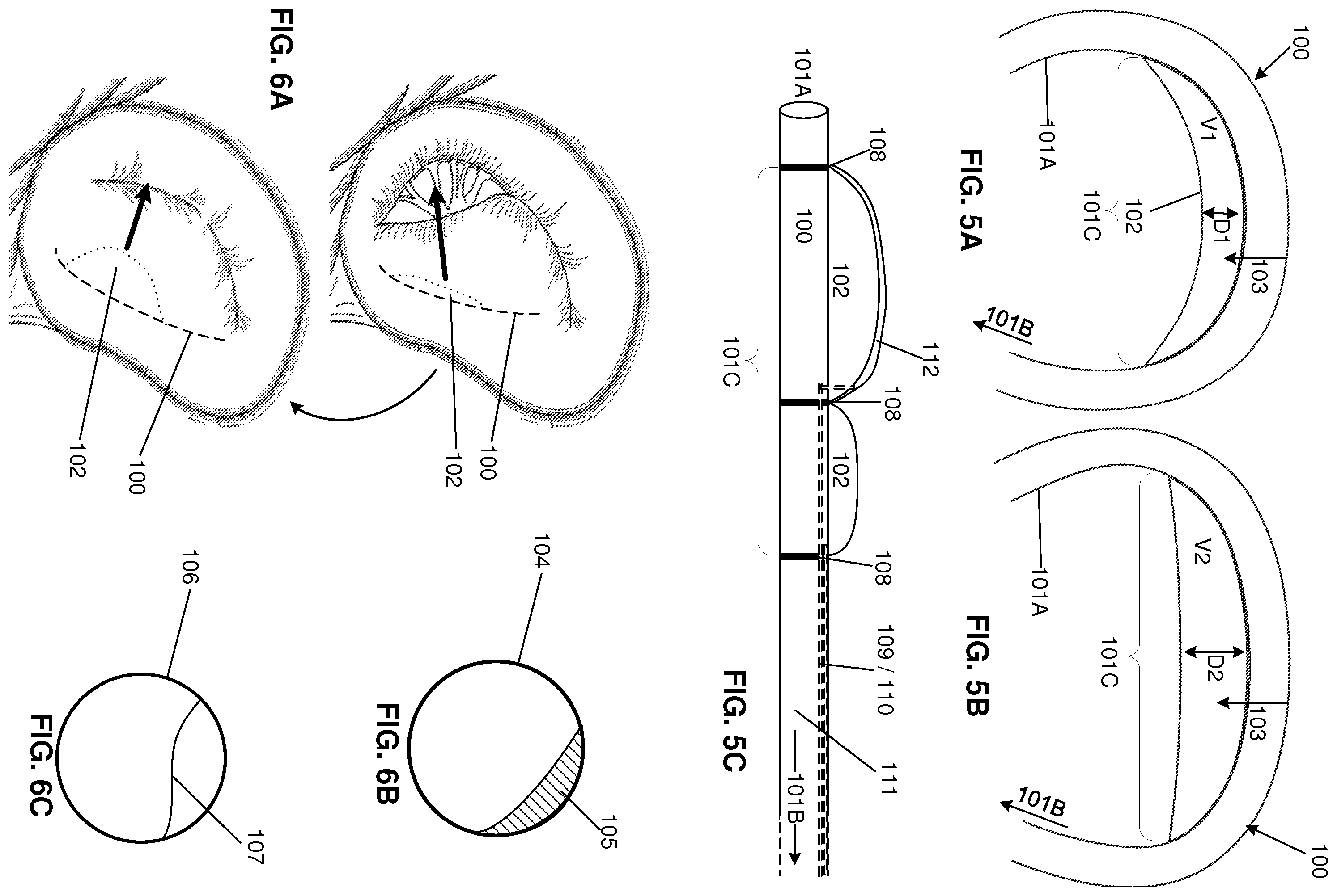 Patent US12569343 Figure 4 – Catheter for manipulating anatomical structure and relative position of the catheter and the anatomical structure