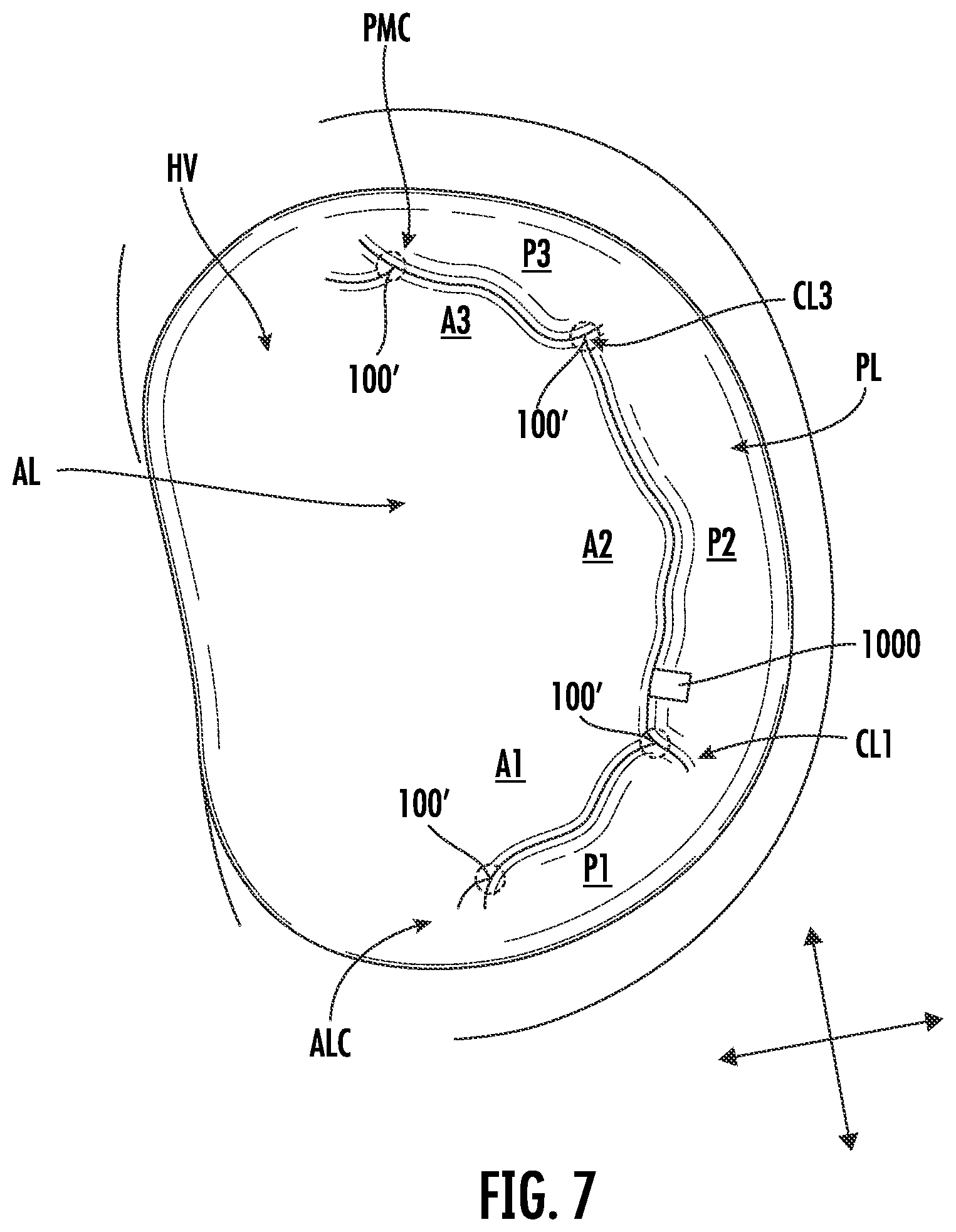 Patent US12569344 Figure 7 – Devices, systems, and methods for clamping a leaflet of a heart valve