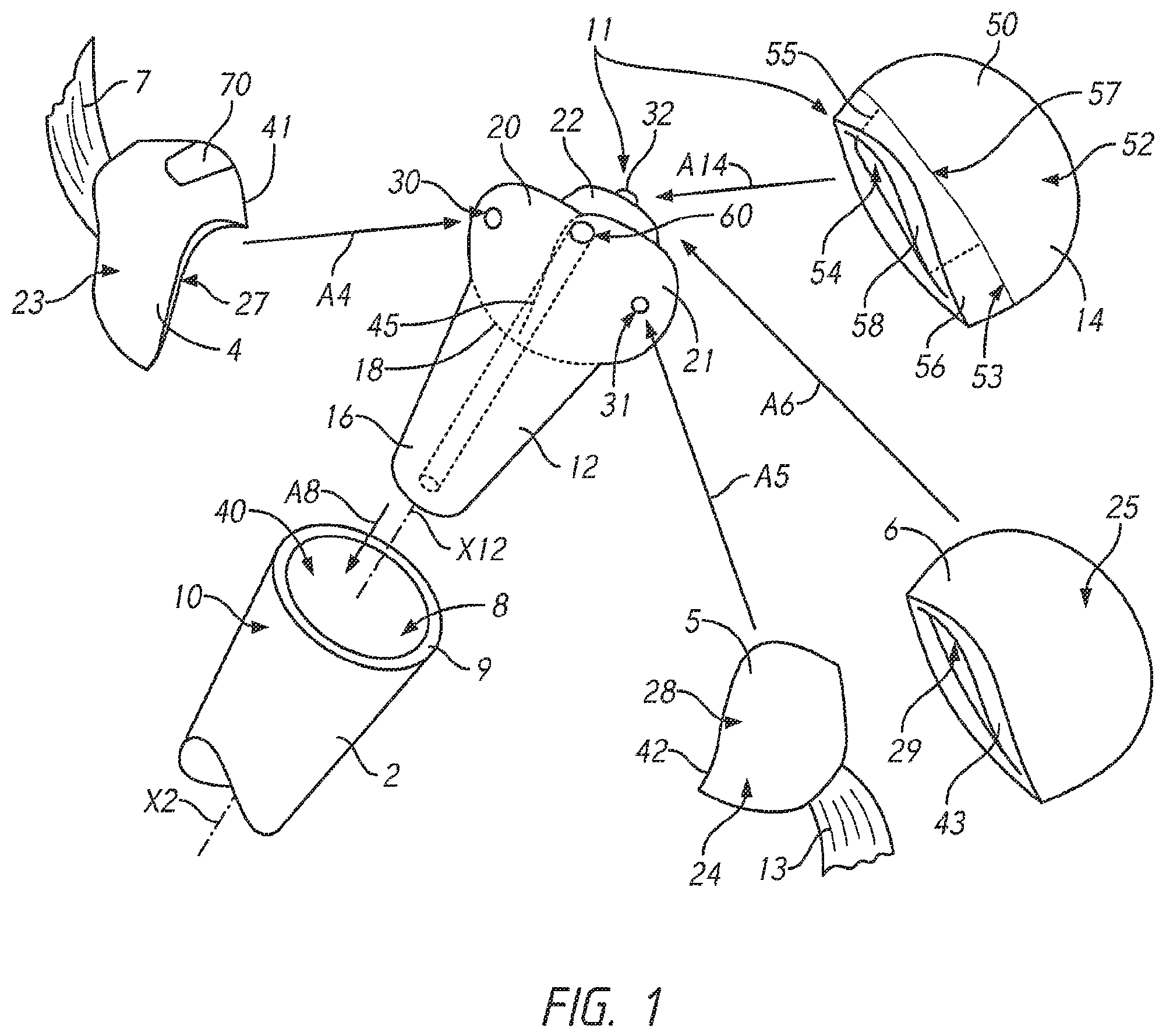 Patent US12569346 Figure 1 – Patient-specific bone fracture prostheses and methods of making the same