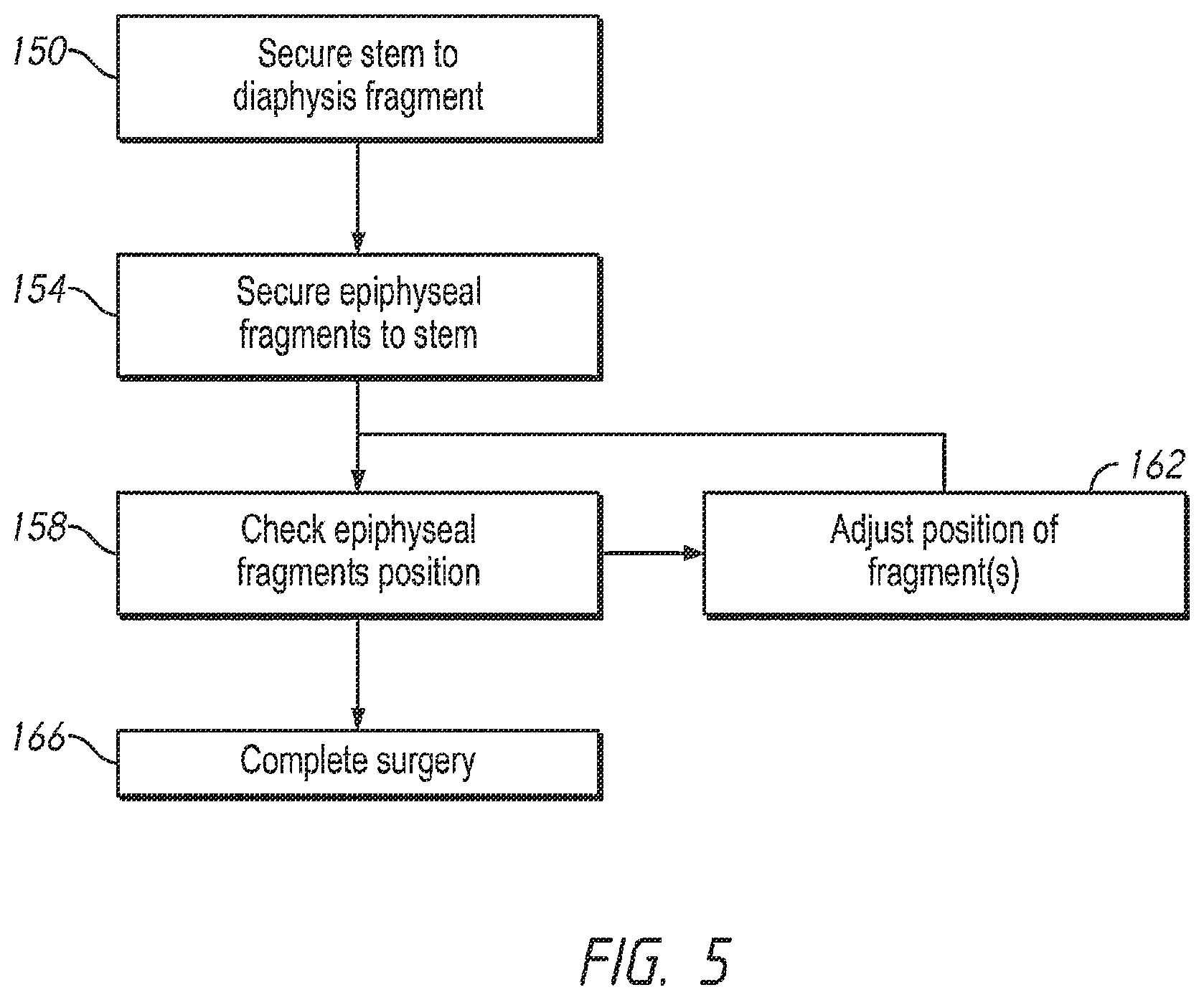 Patent US12569346 Figure 5 – Patient-specific bone fracture prostheses and methods of making the same