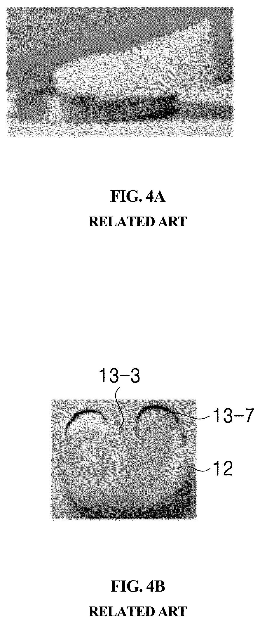 Patent US12569348 Figure 4 – Bearing component for artificial knee joint