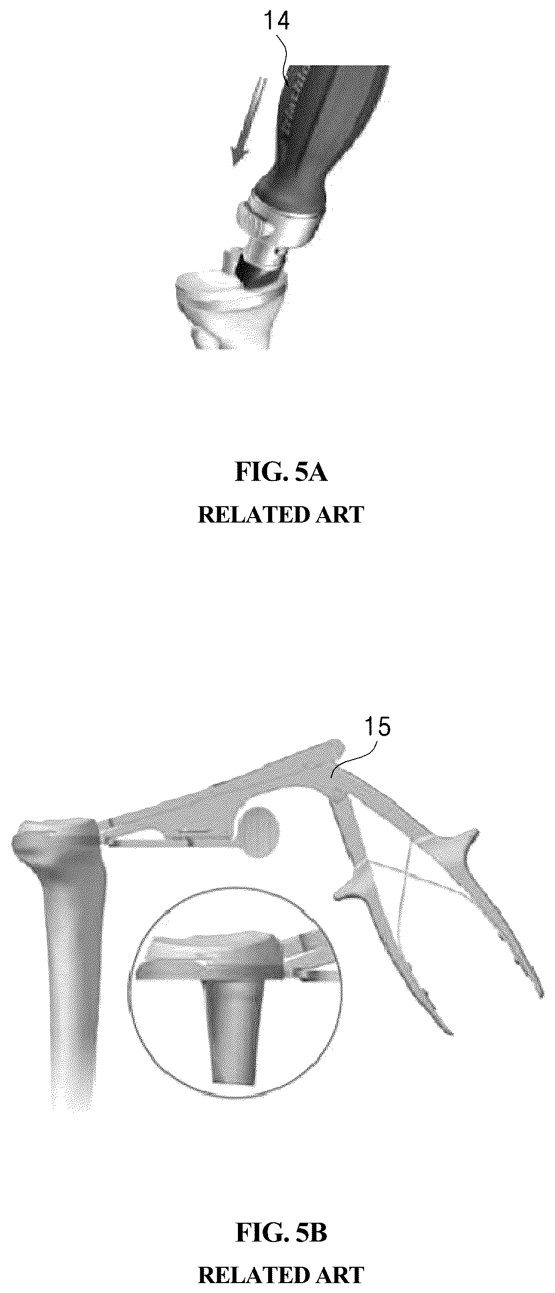 Patent US12569348 Figure 6 – Bearing component for artificial knee joint