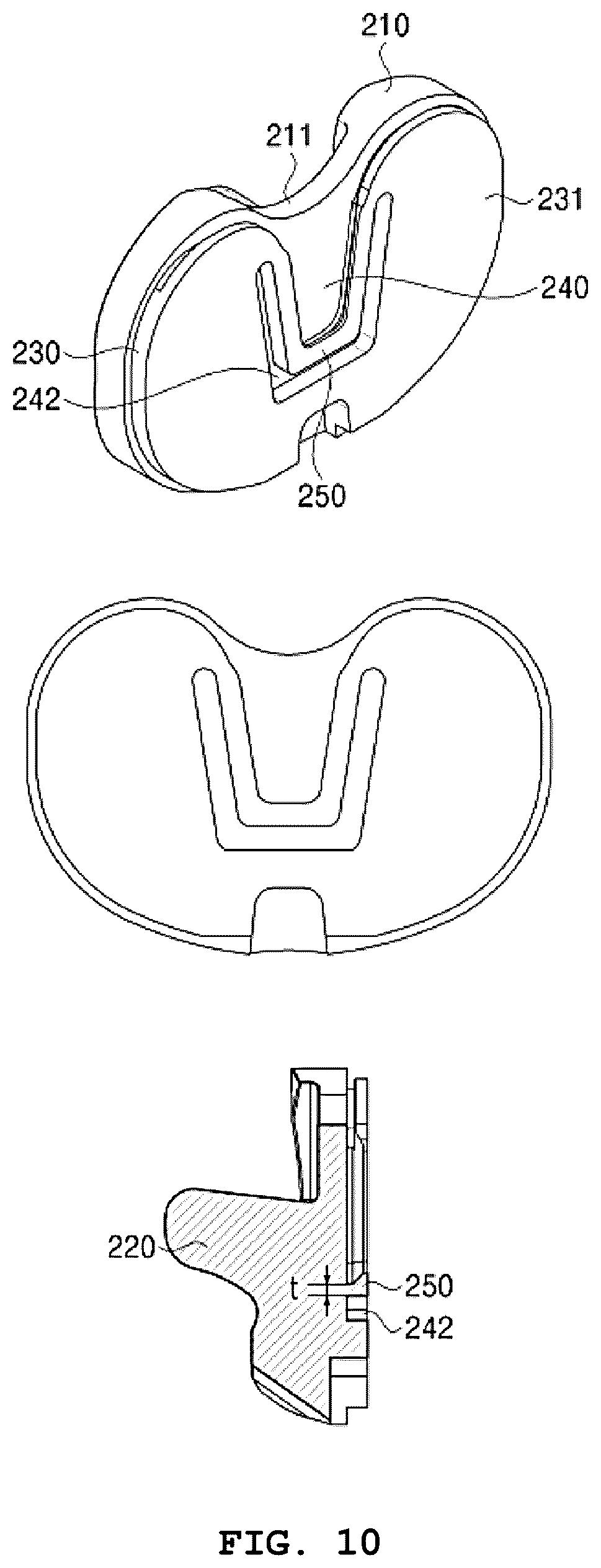 Patent US12569348 Figure 10 – Bearing component for artificial knee joint