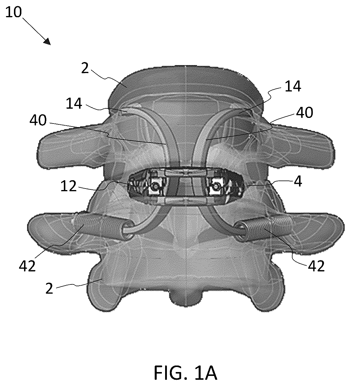 Patent US12569350 Figure 1 – Interlaminar lumbar interbody fusion implants, intradiscal implants, instruments, and methods