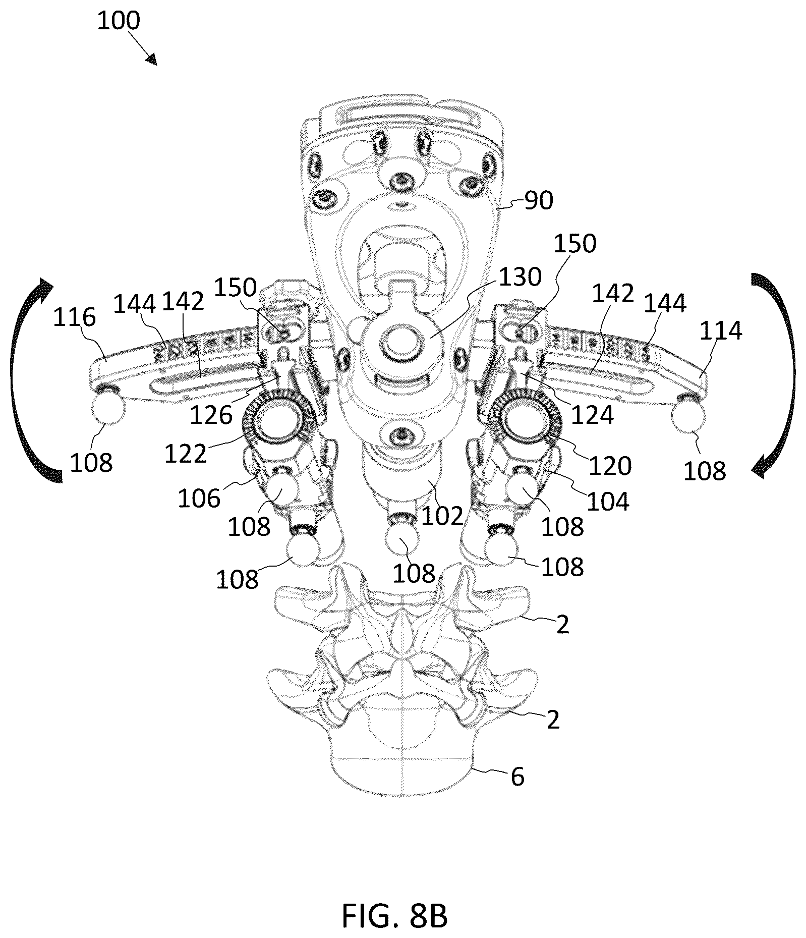 Patent US12569350 Figure 10 – Interlaminar lumbar interbody fusion implants, intradiscal implants, instruments, and methods
