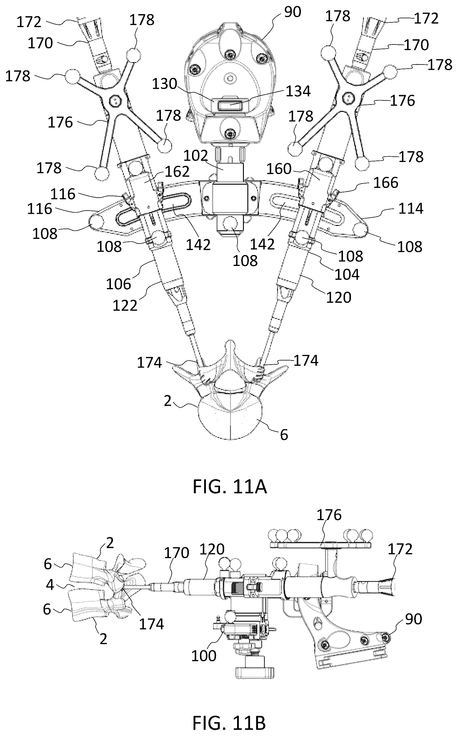 Patent US12569350 Figure 15 – Interlaminar lumbar interbody fusion implants, intradiscal implants, instruments, and methods