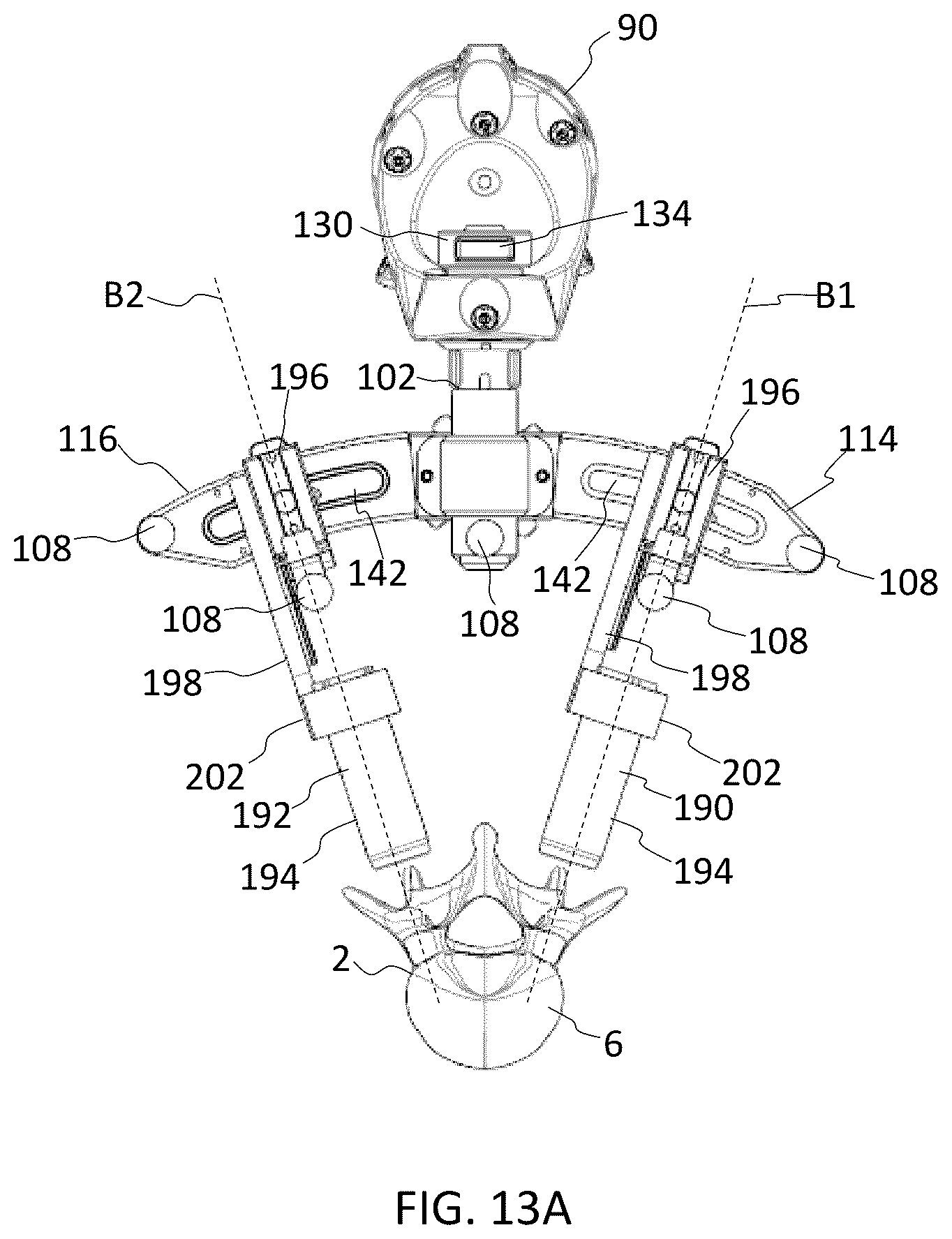 Patent US12569350 Figure 17 – Interlaminar lumbar interbody fusion implants, intradiscal implants, instruments, and methods