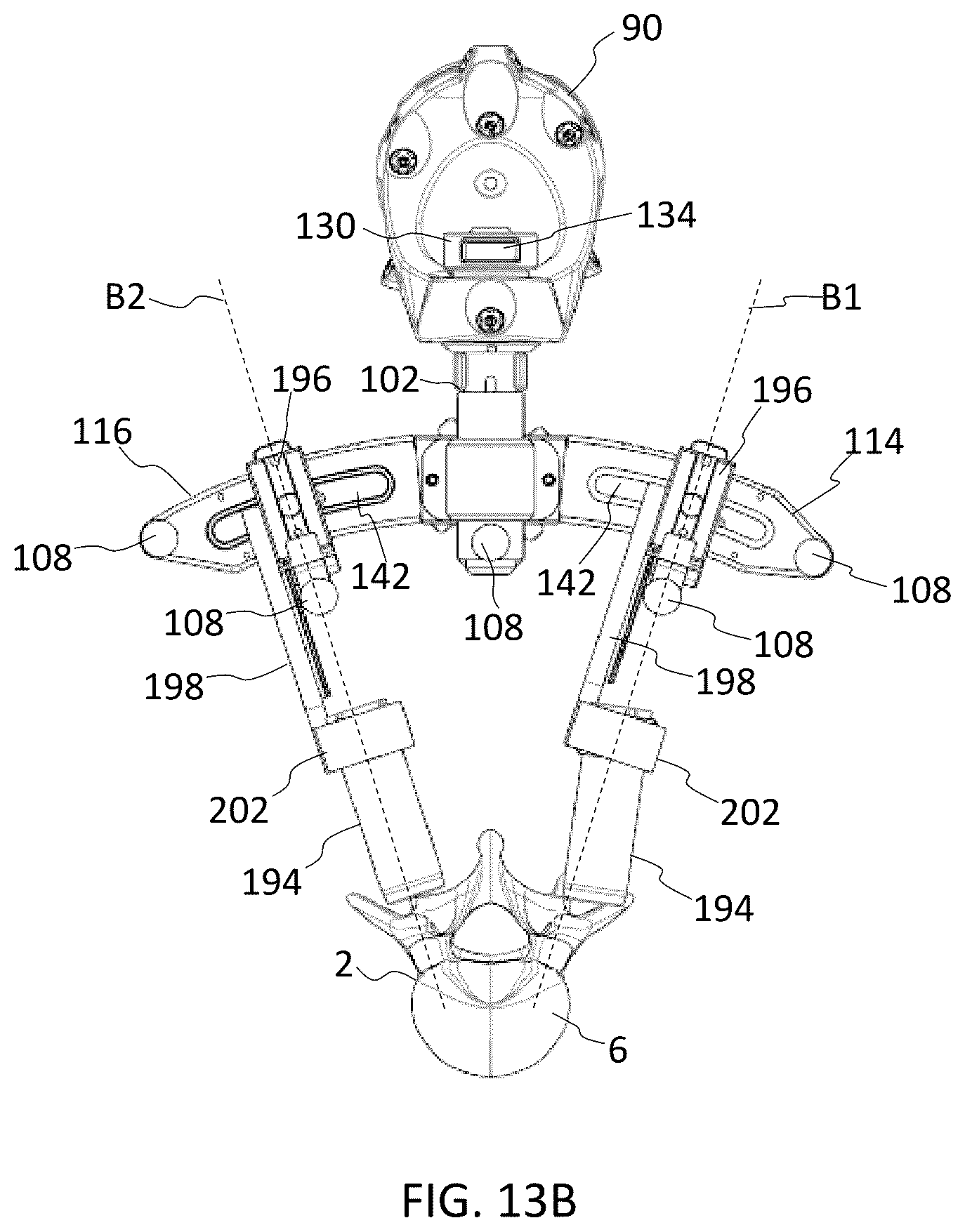 Patent US12569350 Figure 18 – Interlaminar lumbar interbody fusion implants, intradiscal implants, instruments, and methods