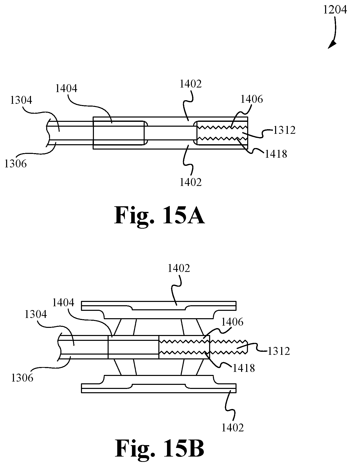 Patent US12569351 Figure 18 – Bone fusion device