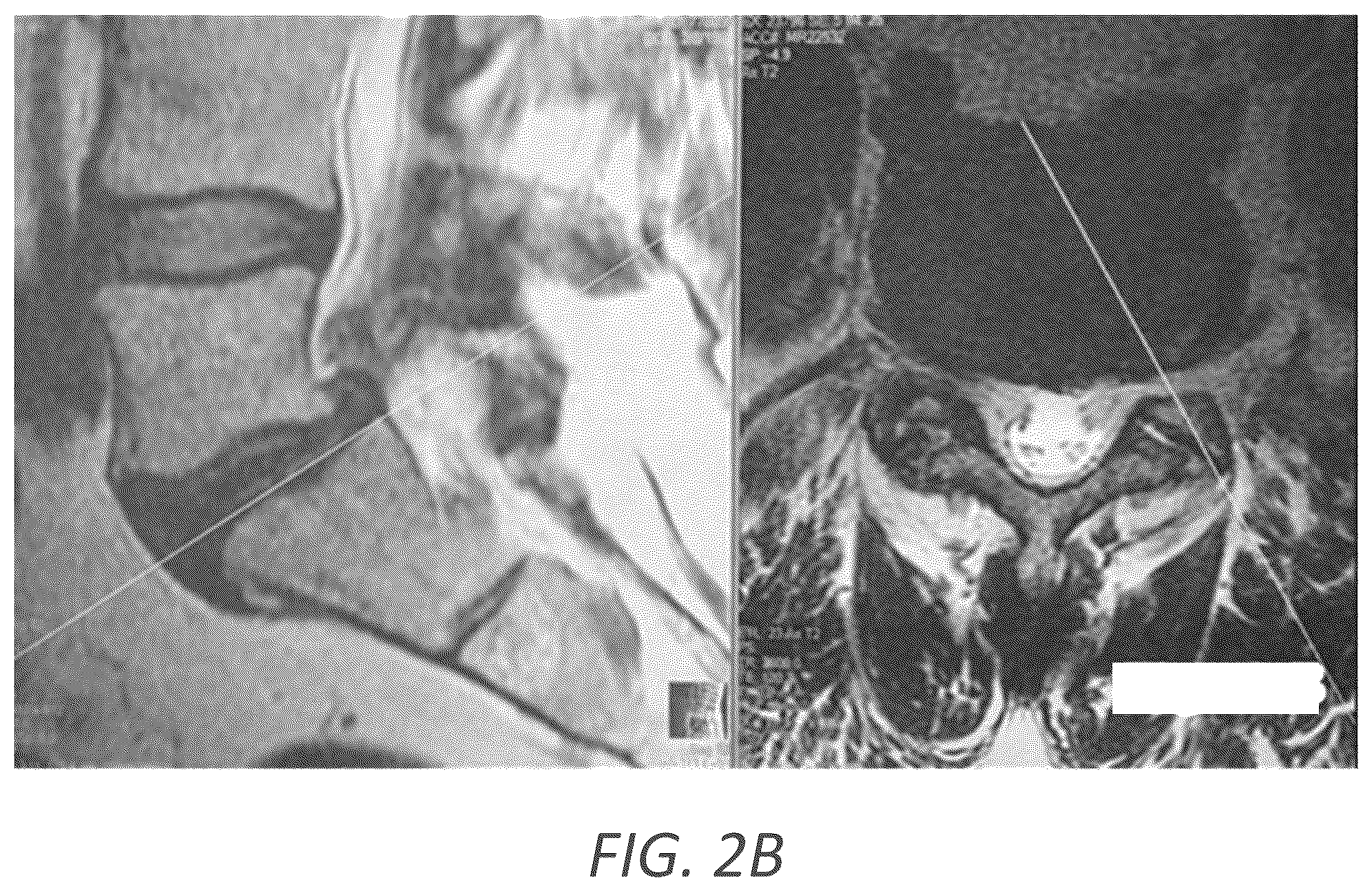 Patent US12569352 Figure 4 – Minimally invasive robotic assisted trans-facet lumbar interbody fusion