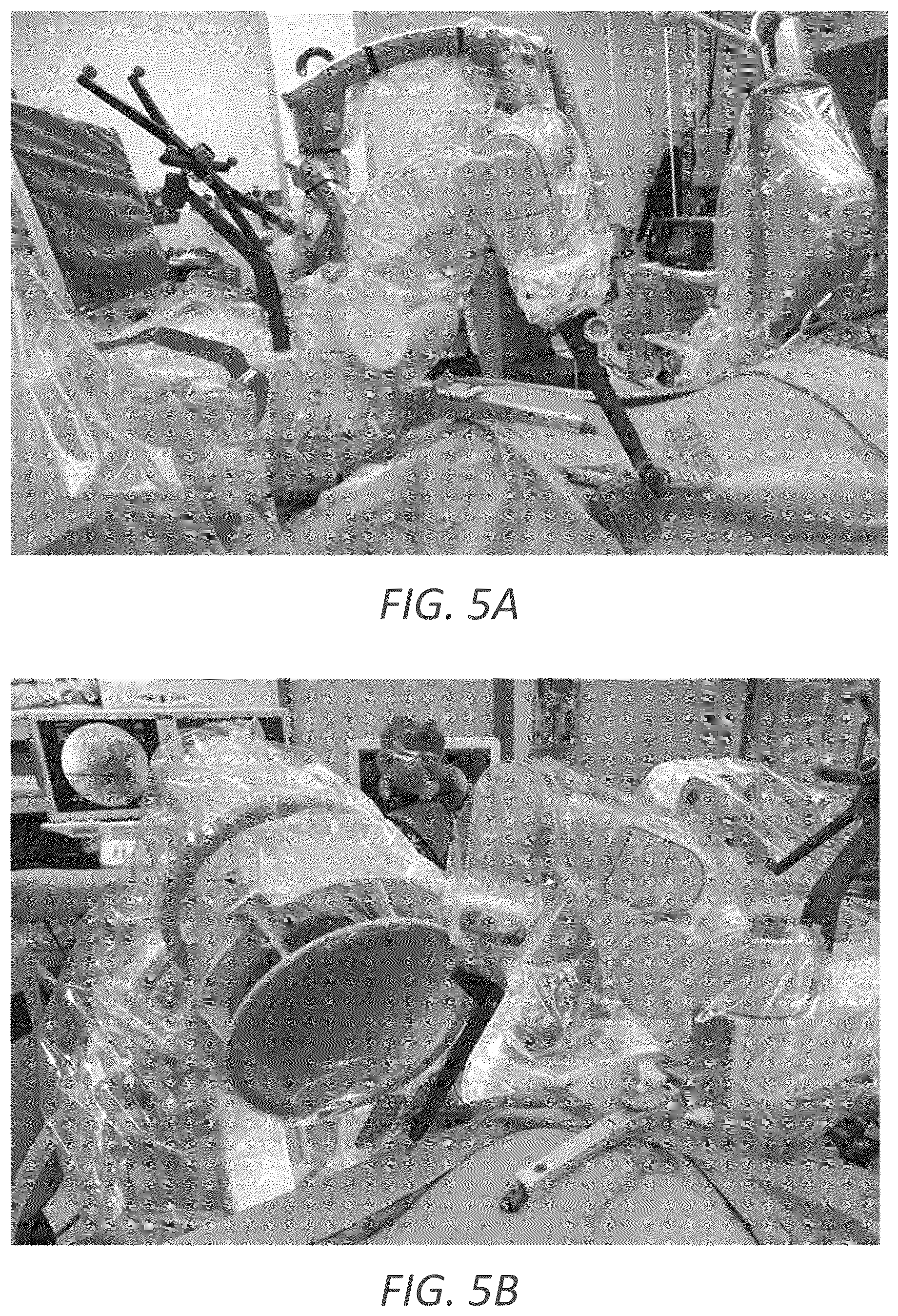 Patent US12569352 Figure 8 – Minimally invasive robotic assisted trans-facet lumbar interbody fusion