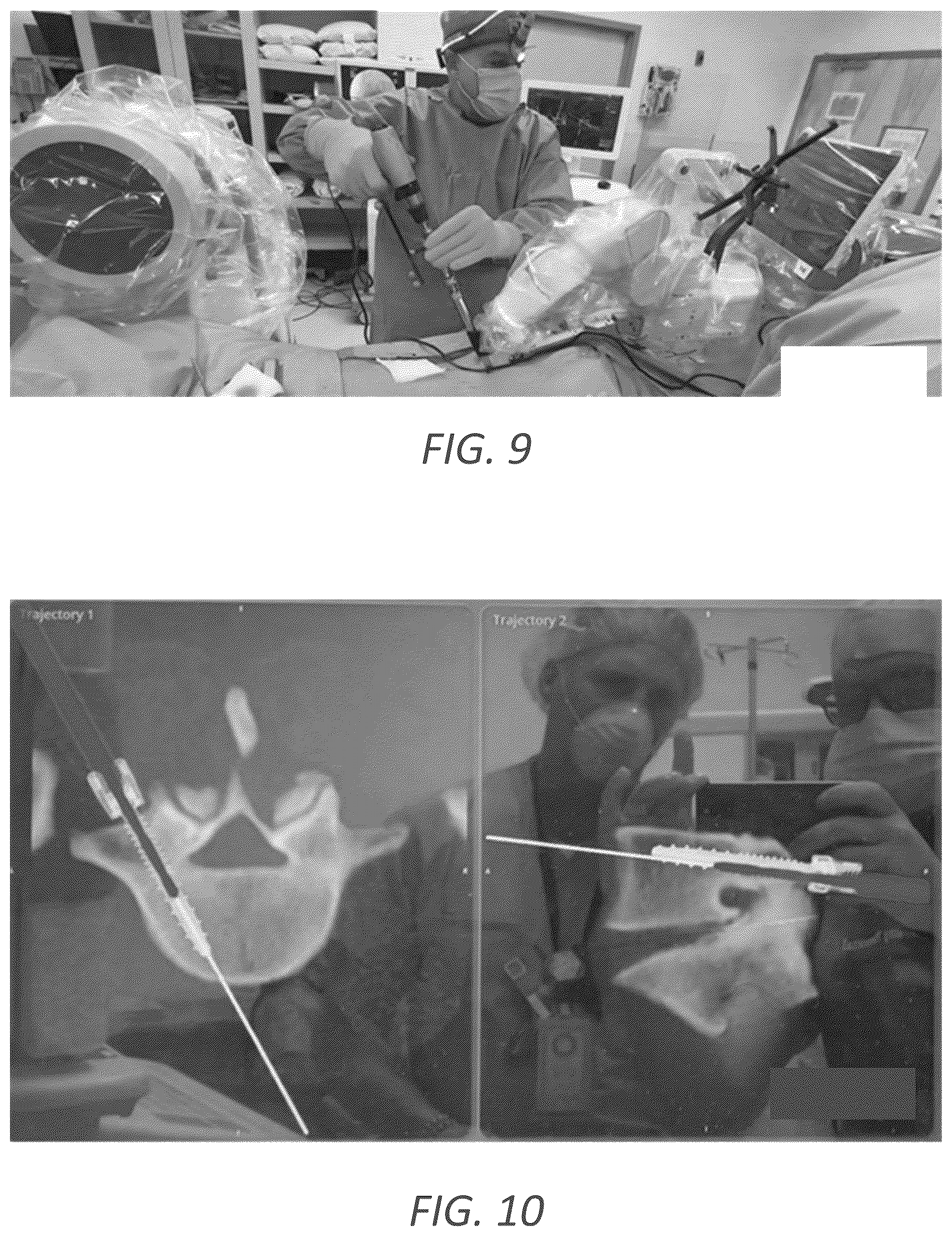 Patent US12569352 Figure 13 – Minimally invasive robotic assisted trans-facet lumbar interbody fusion