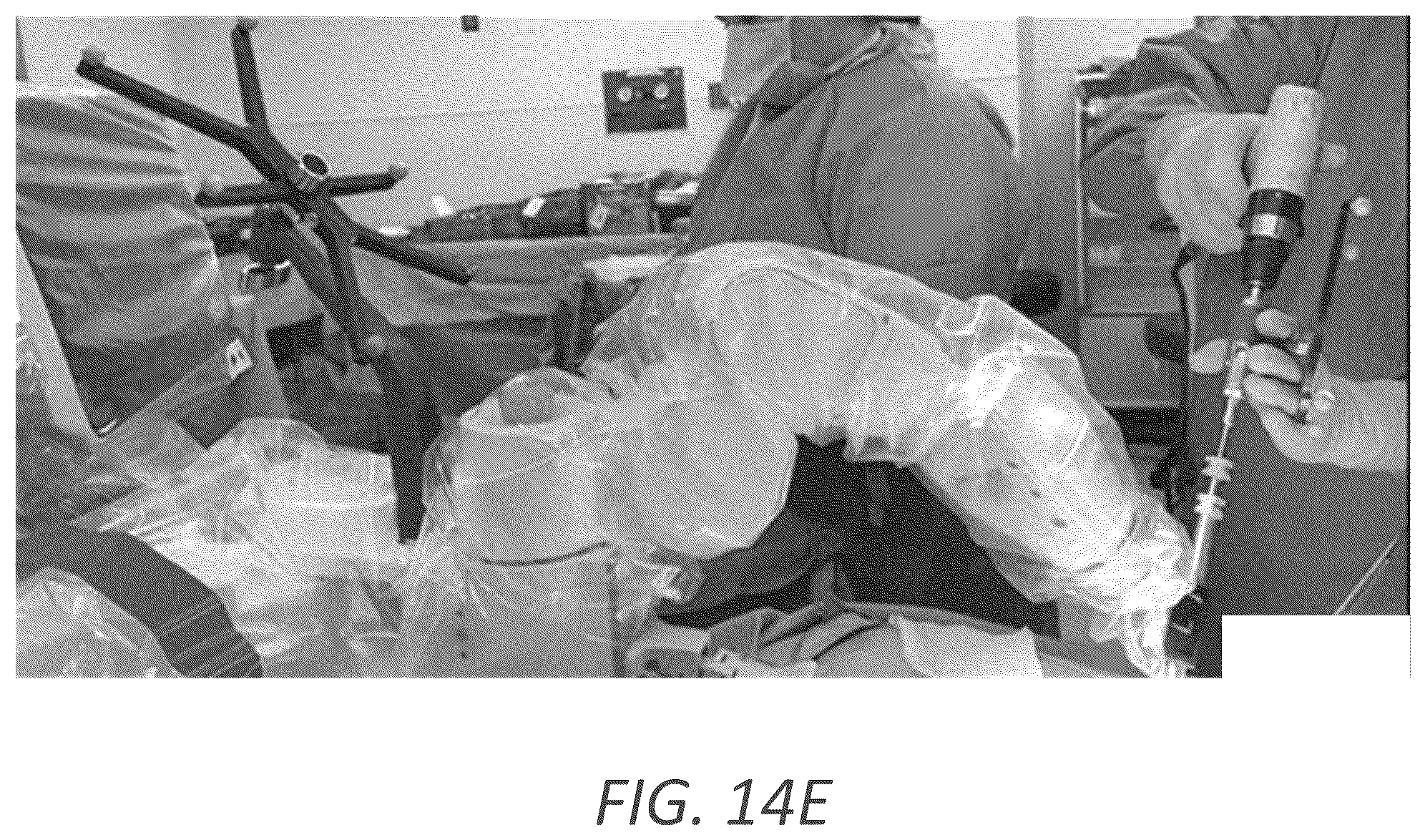 Patent US12569352 Figure 20 – Minimally invasive robotic assisted trans-facet lumbar interbody fusion