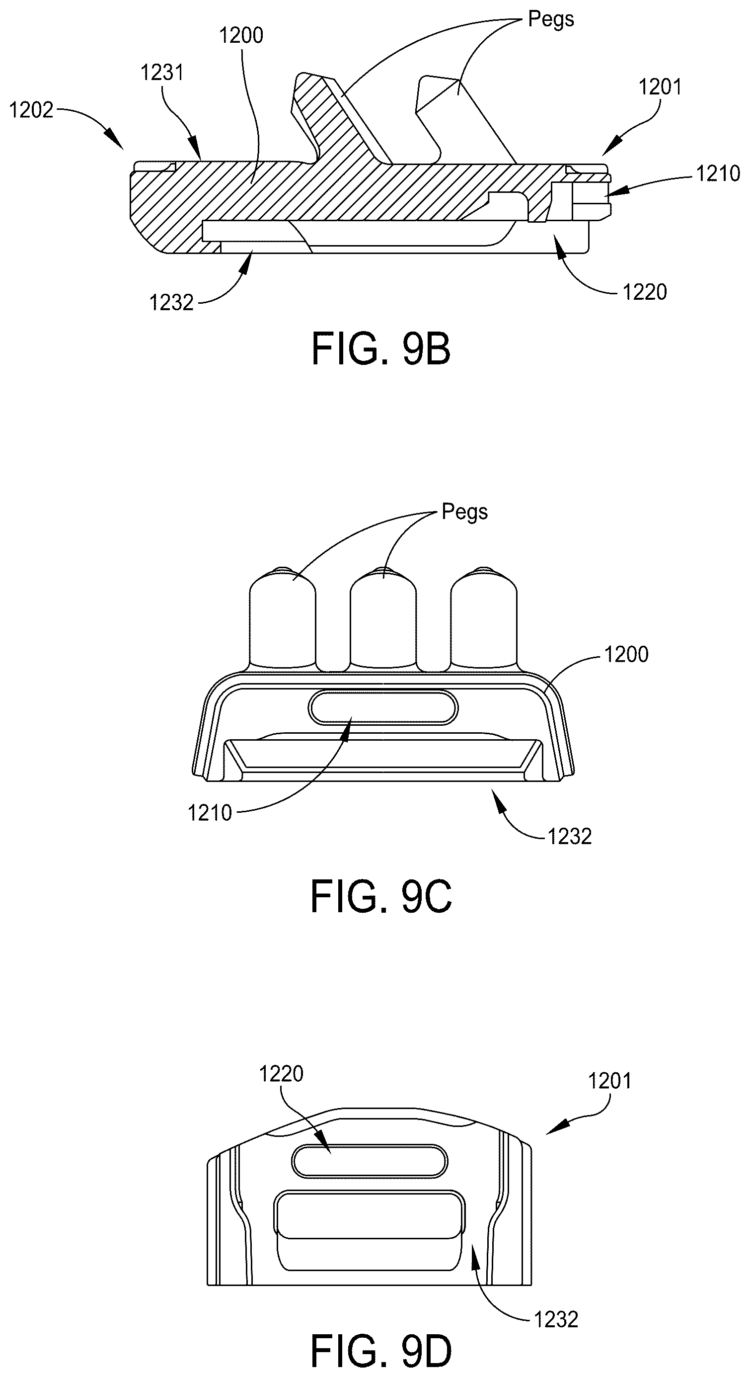 Patent US12569355 Figure 13 – Systems and methods for total ankle arthroplasty