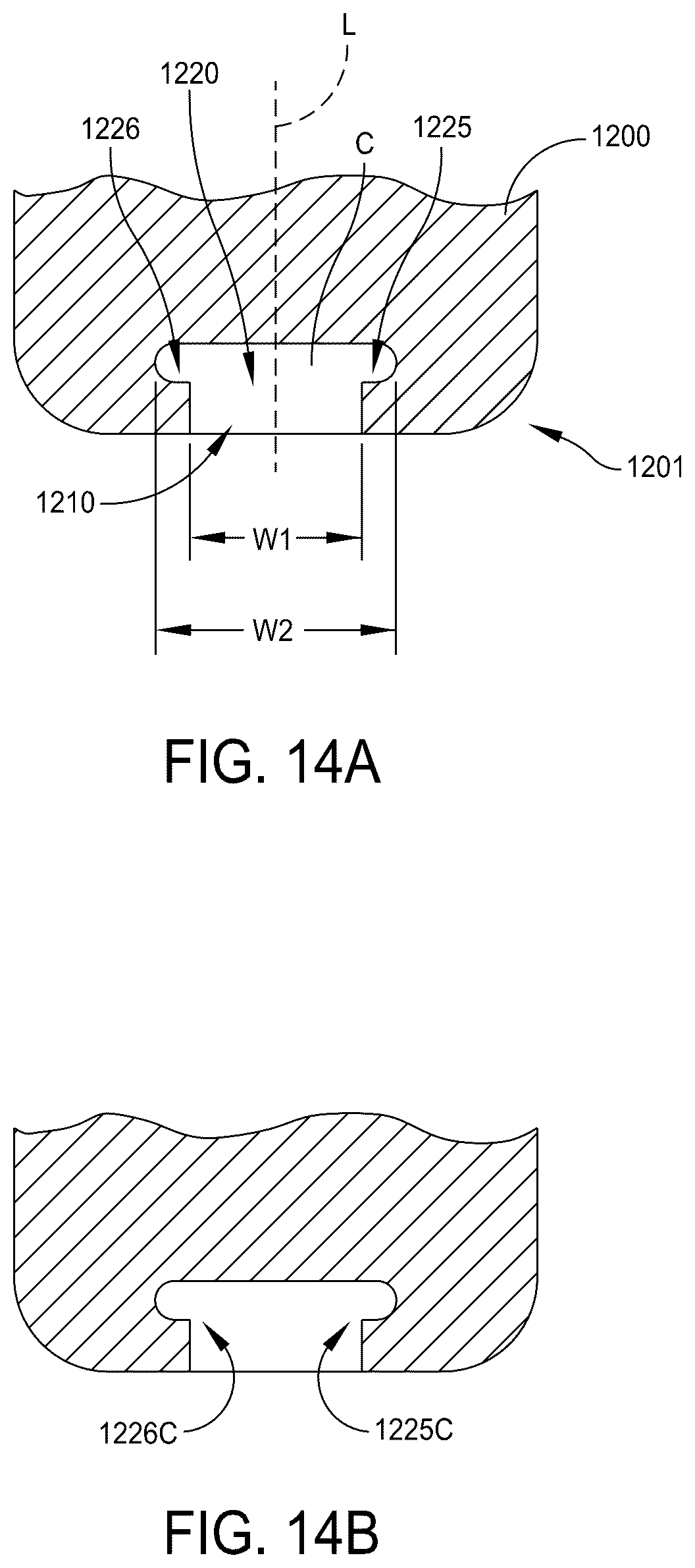 Patent US12569355 Figure 16 – Systems and methods for total ankle arthroplasty