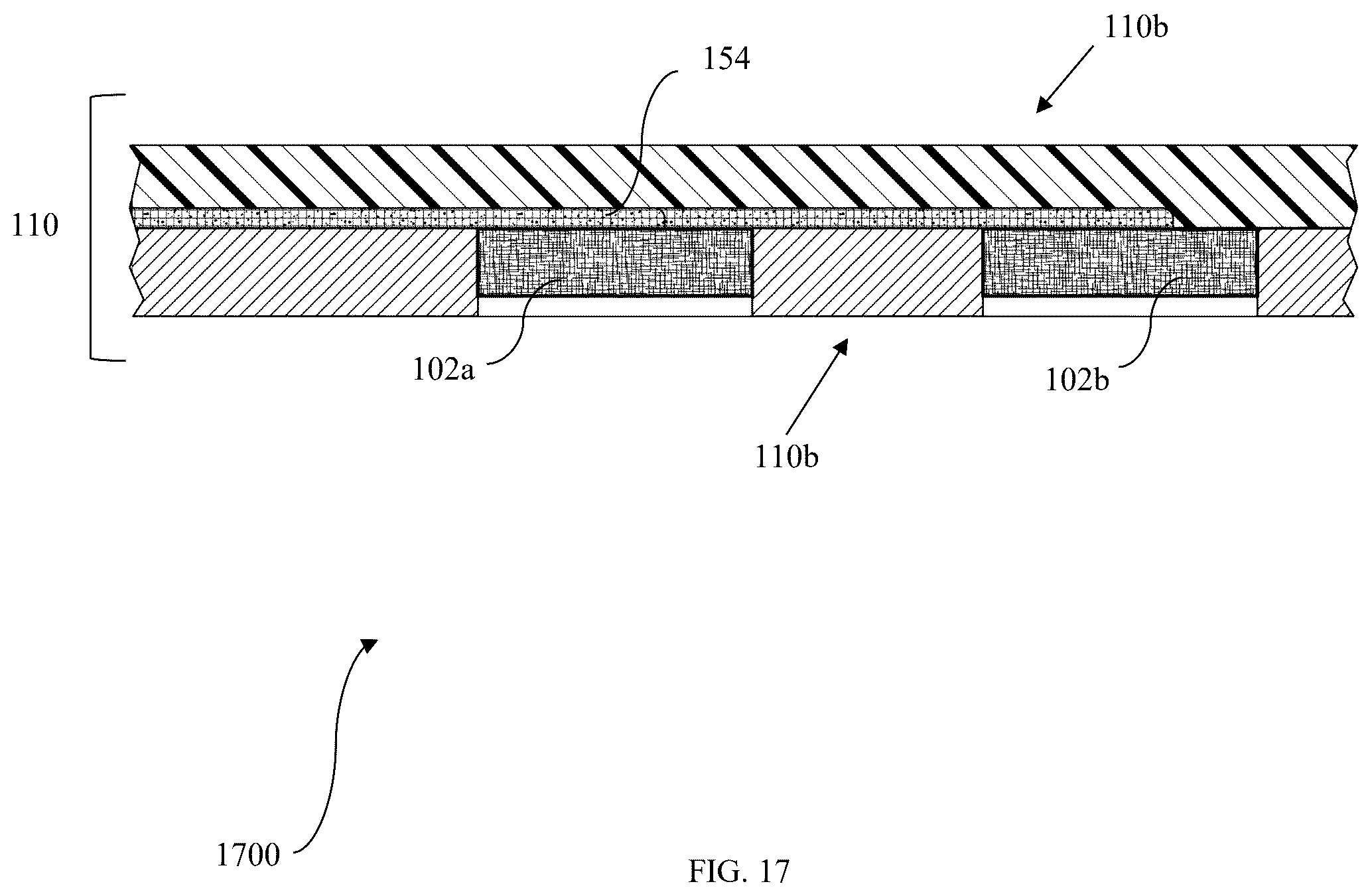 Patent US12569359 Figure 17 – System for residual limbs of amputees