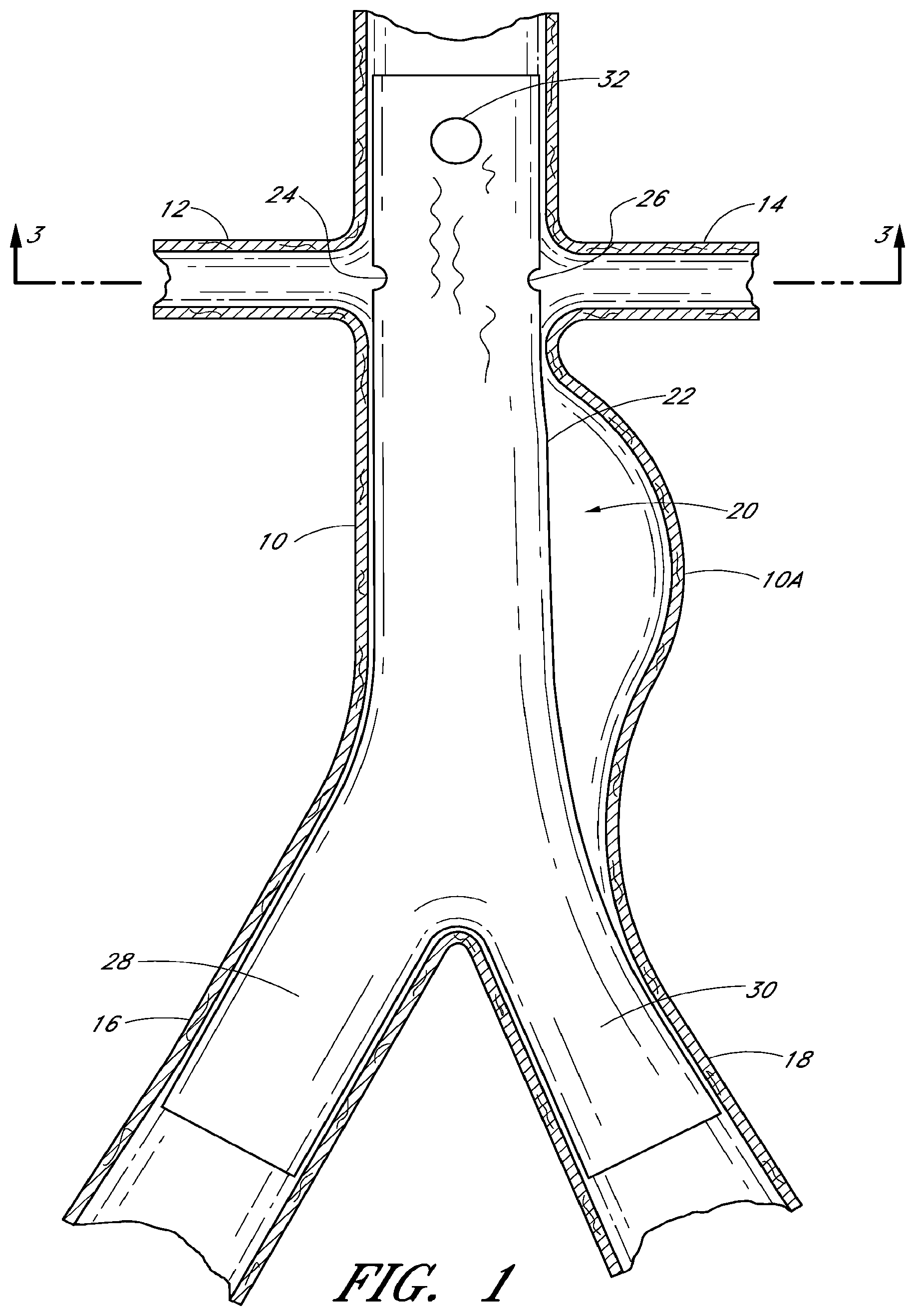 Patent US12569360 Figure 1 – Apparatus and method of placement of a graft or graft system