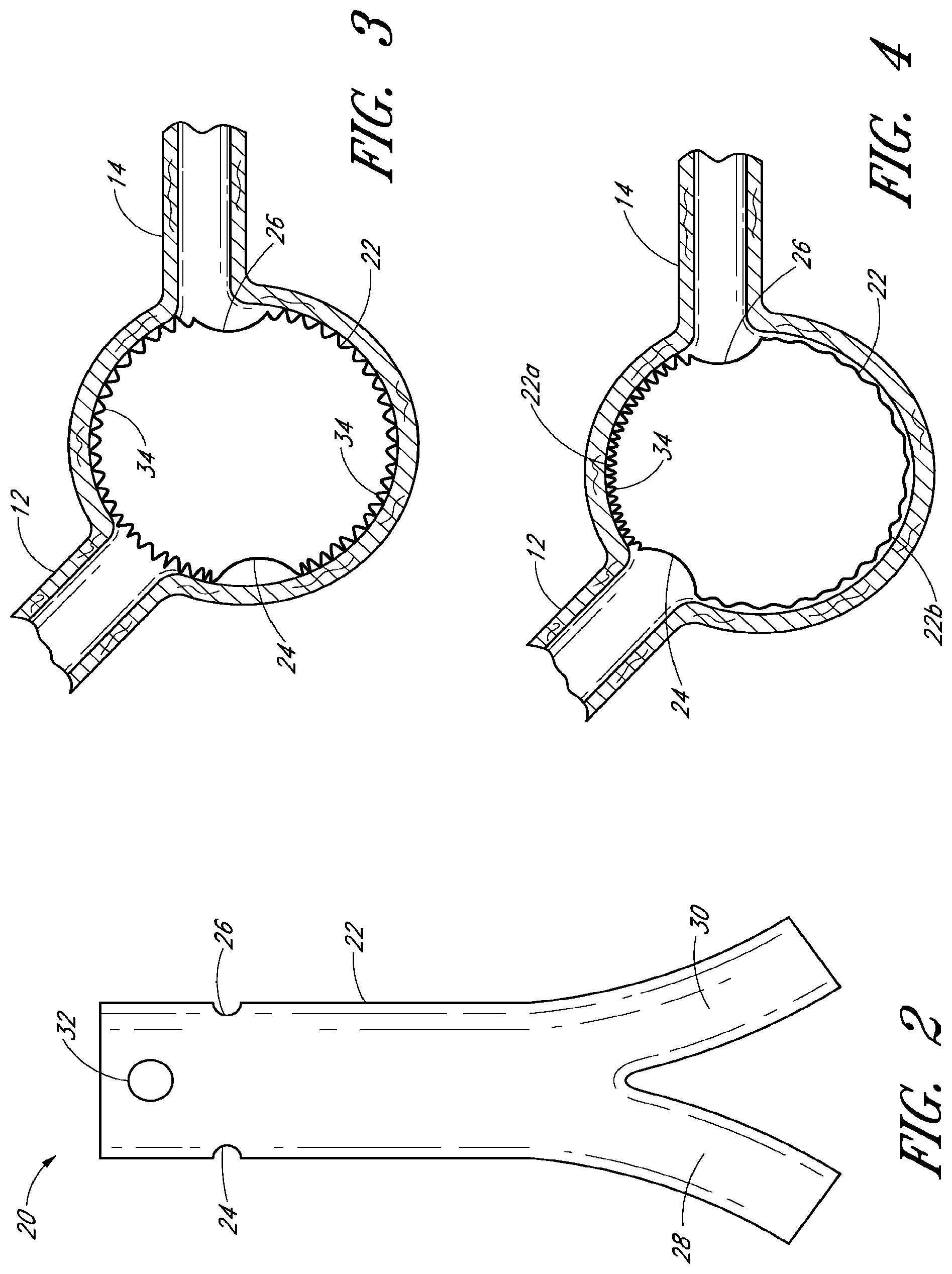 Patent US12569360 Figure 2 – Apparatus and method of placement of a graft or graft system