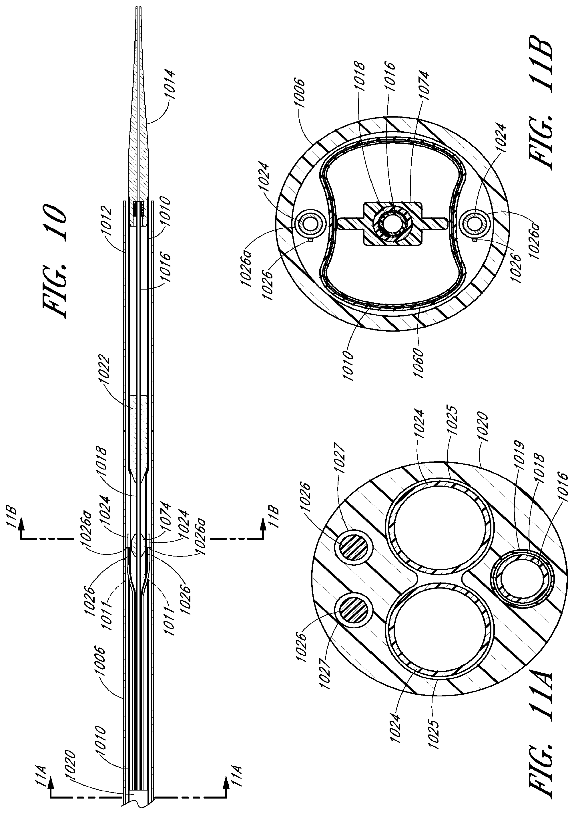 Patent US12569360 Figure 9 – Apparatus and method of placement of a graft or graft system