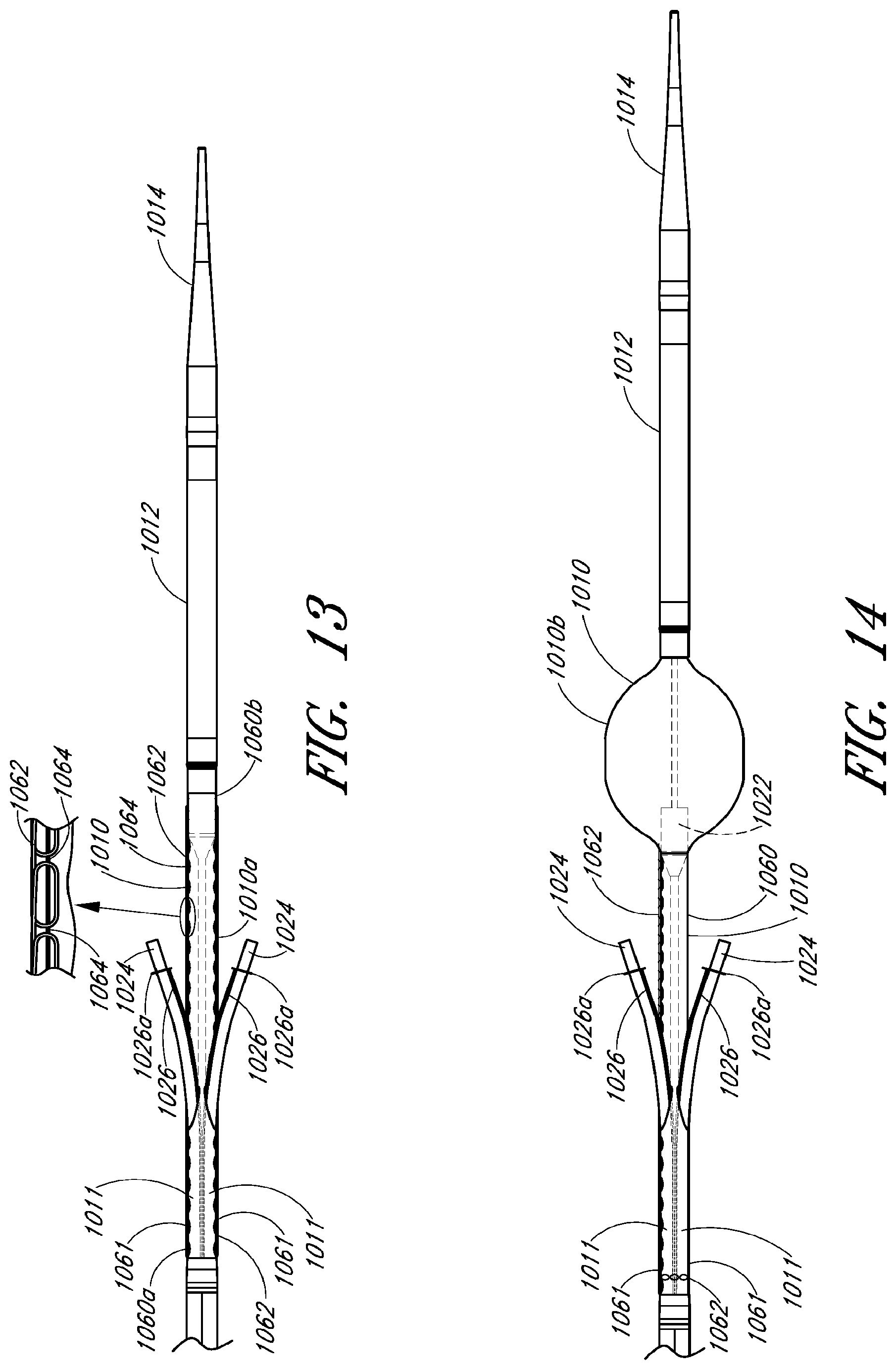 Patent US12569360 Figure 11 – Apparatus and method of placement of a graft or graft system
