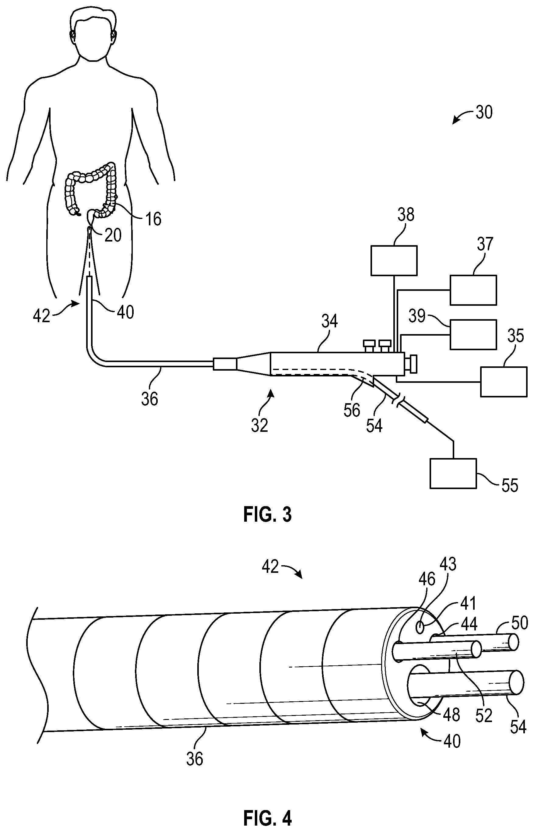 Patent US12569361 Figure 2 – Devices and methods to treat and prevent diverticulitis