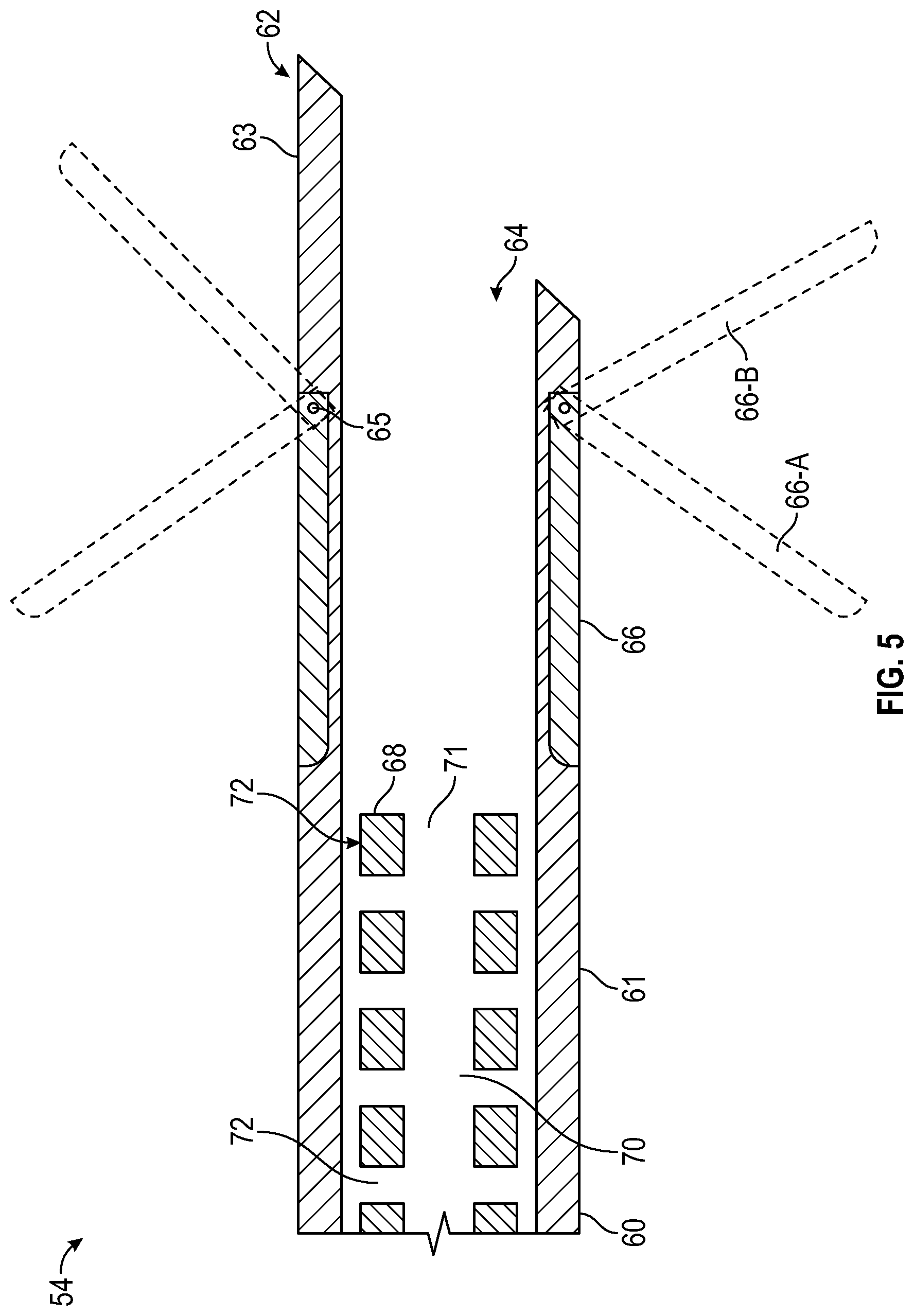 Patent US12569361 Figure 3 – Devices and methods to treat and prevent diverticulitis