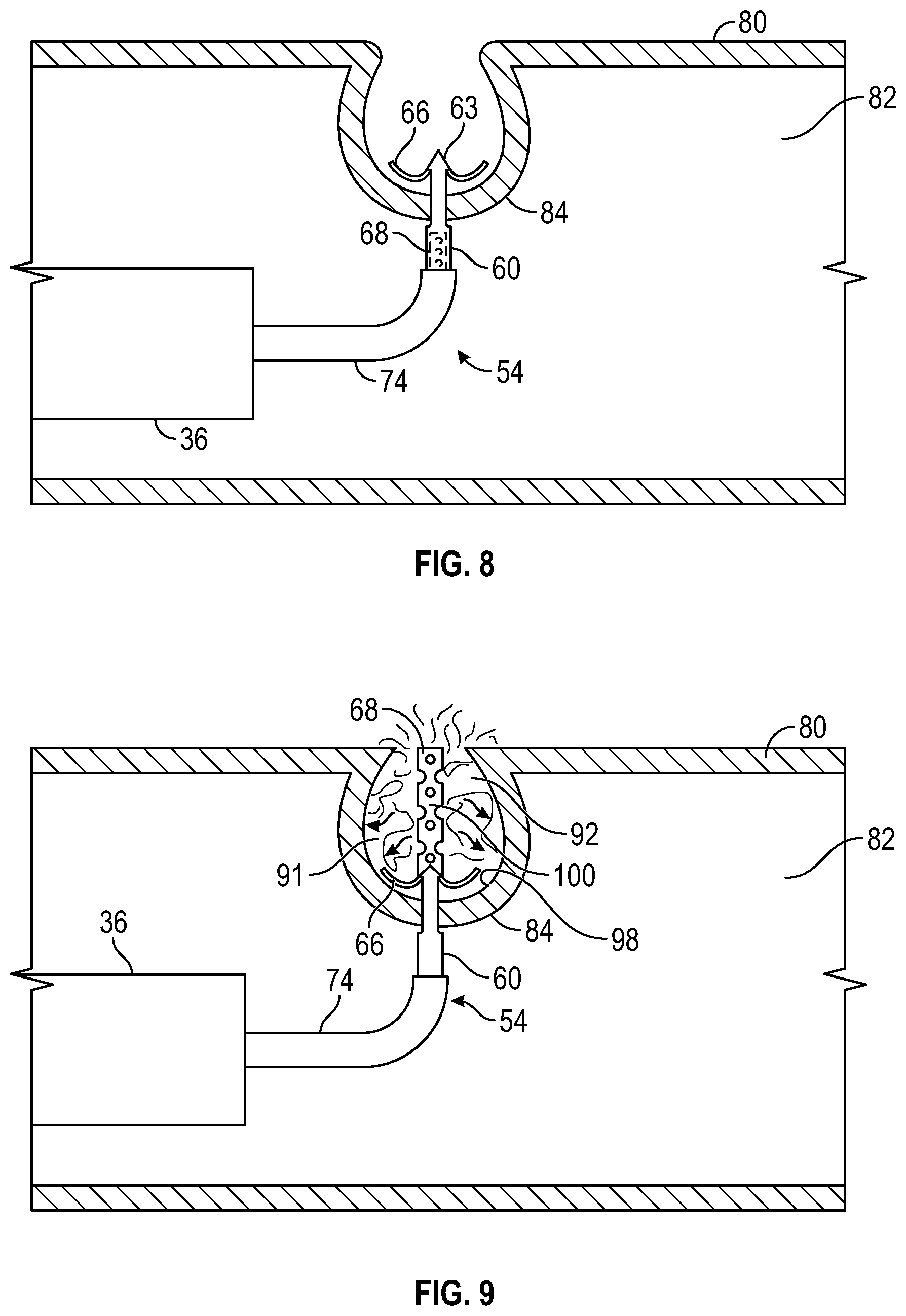 Patent US12569361 Figure 5 – Devices and methods to treat and prevent diverticulitis