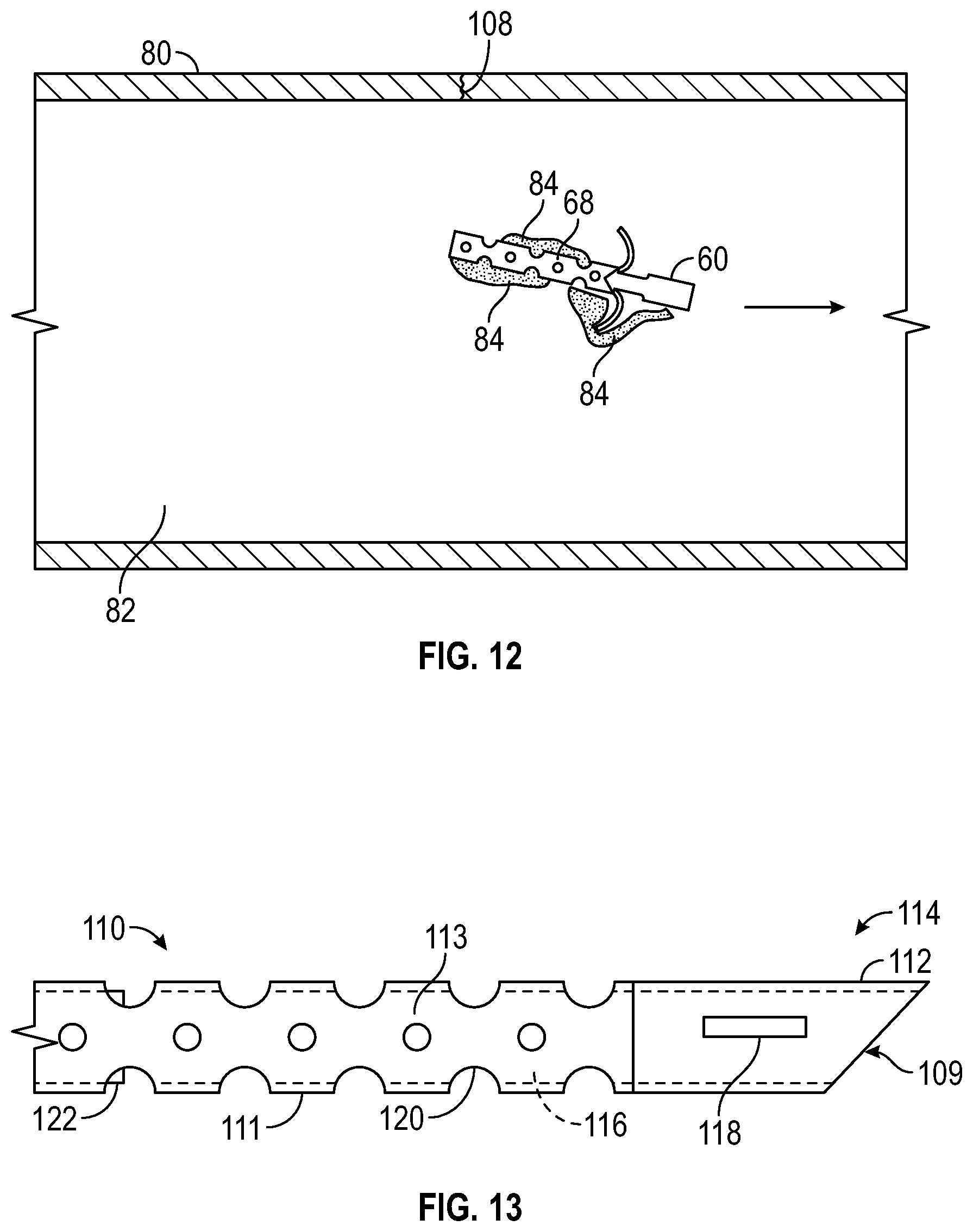 Patent US12569361 Figure 7 – Devices and methods to treat and prevent diverticulitis