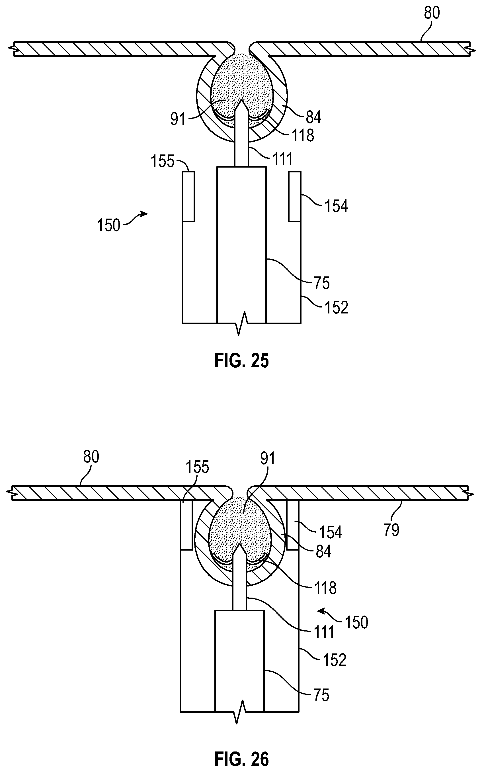 Patent US12569361 Figure 13 – Devices and methods to treat and prevent diverticulitis