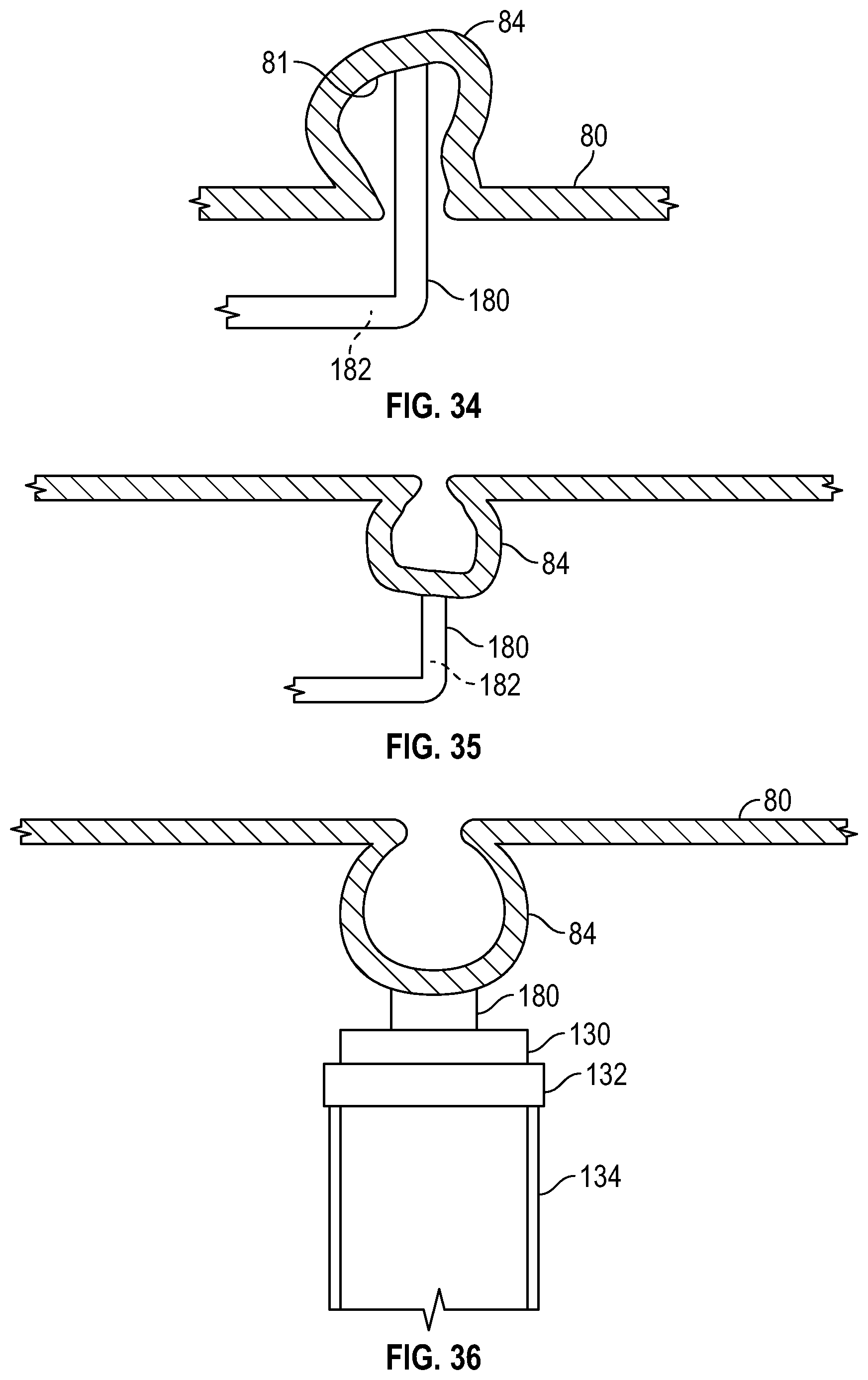 Patent US12569361 Figure 17 – Devices and methods to treat and prevent diverticulitis