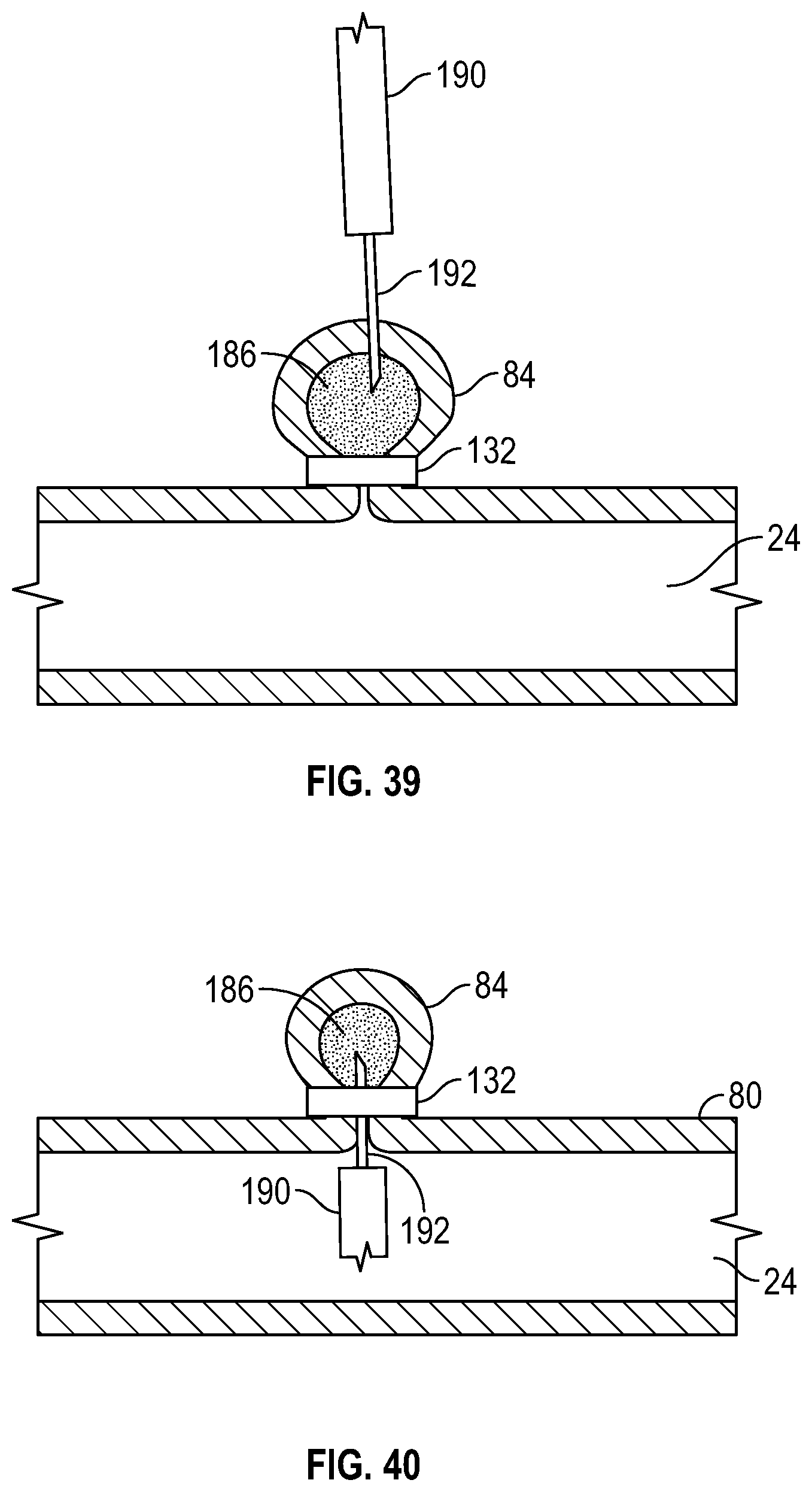 Patent US12569361 Figure 19 – Devices and methods to treat and prevent diverticulitis