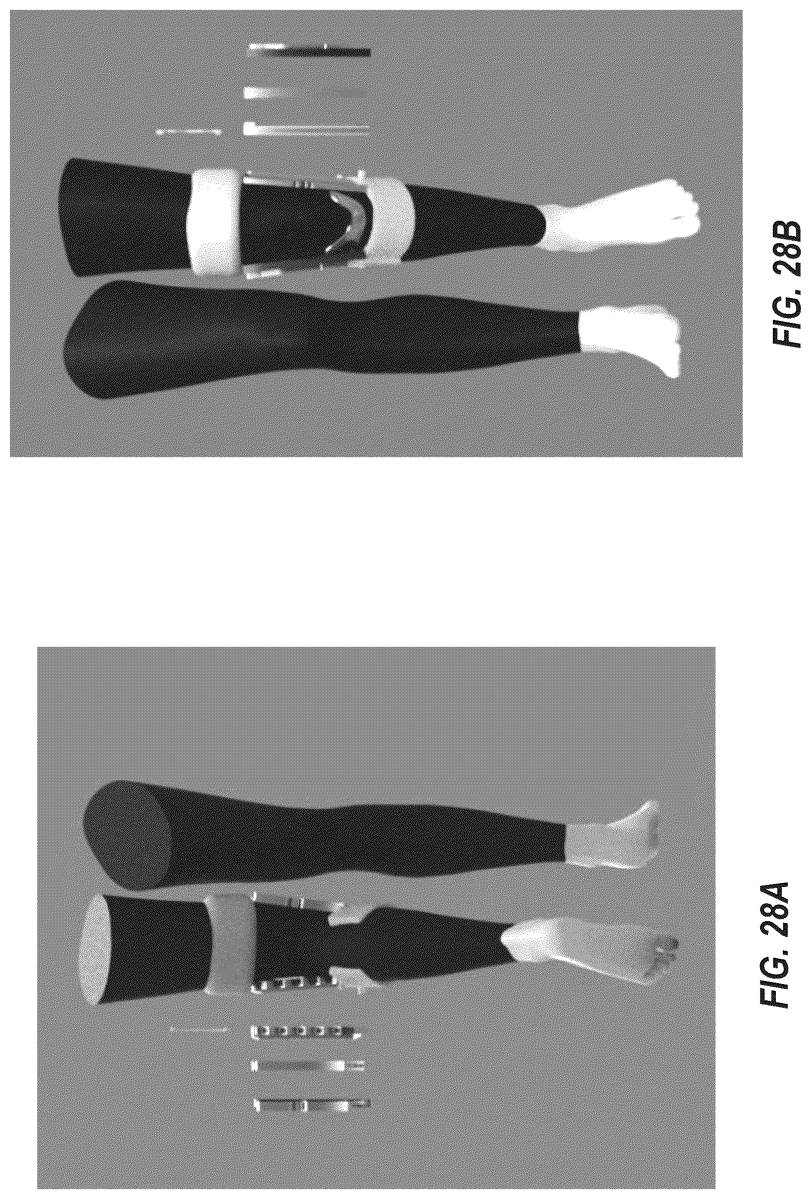Patent US12569363 Figure 20 – Portable system including post-surgical brace with anti-inflammation cooling