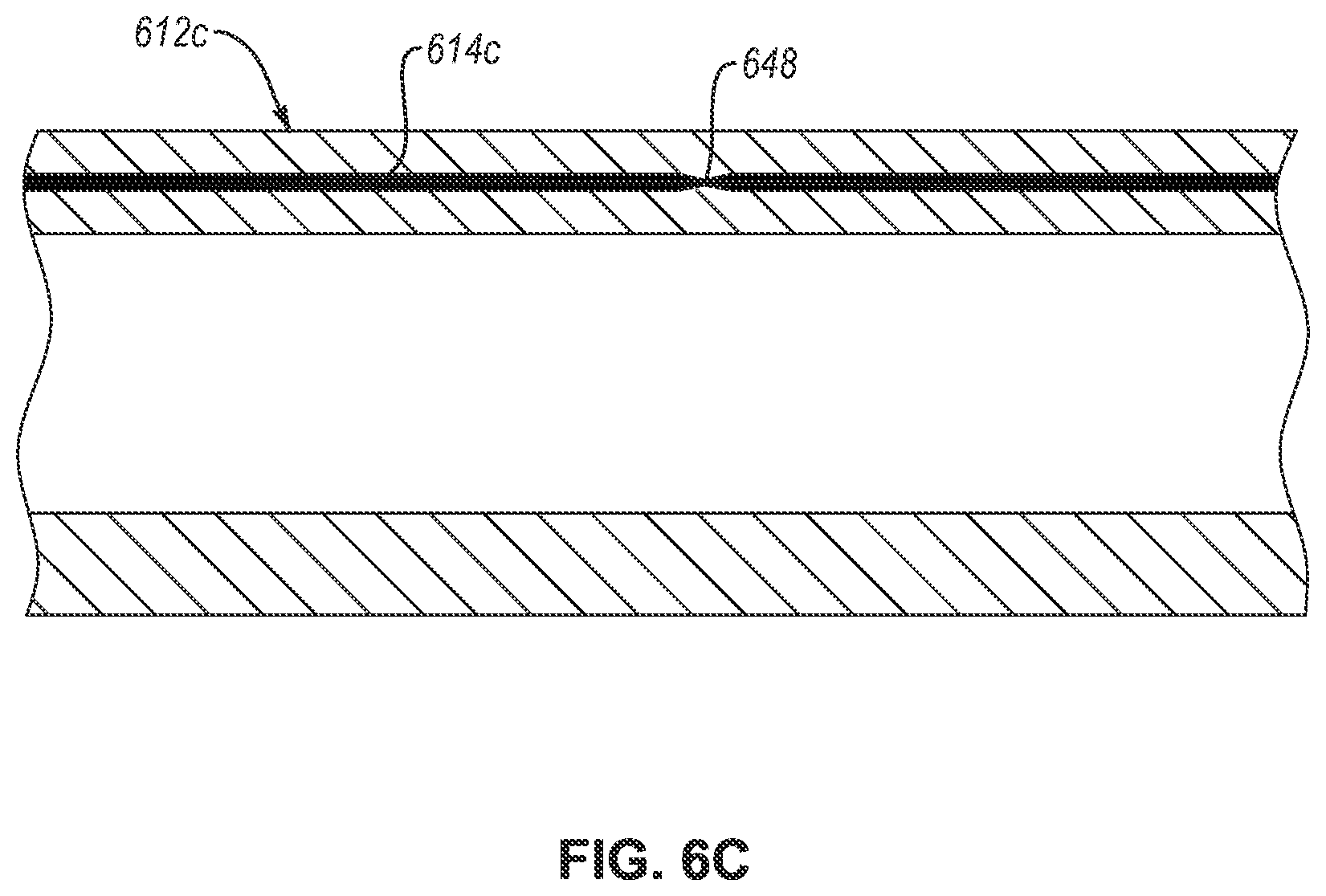 Patent US12569365 Figure 6 – Fluid collection assemblies including at least one shape memory material disposed in the conduit