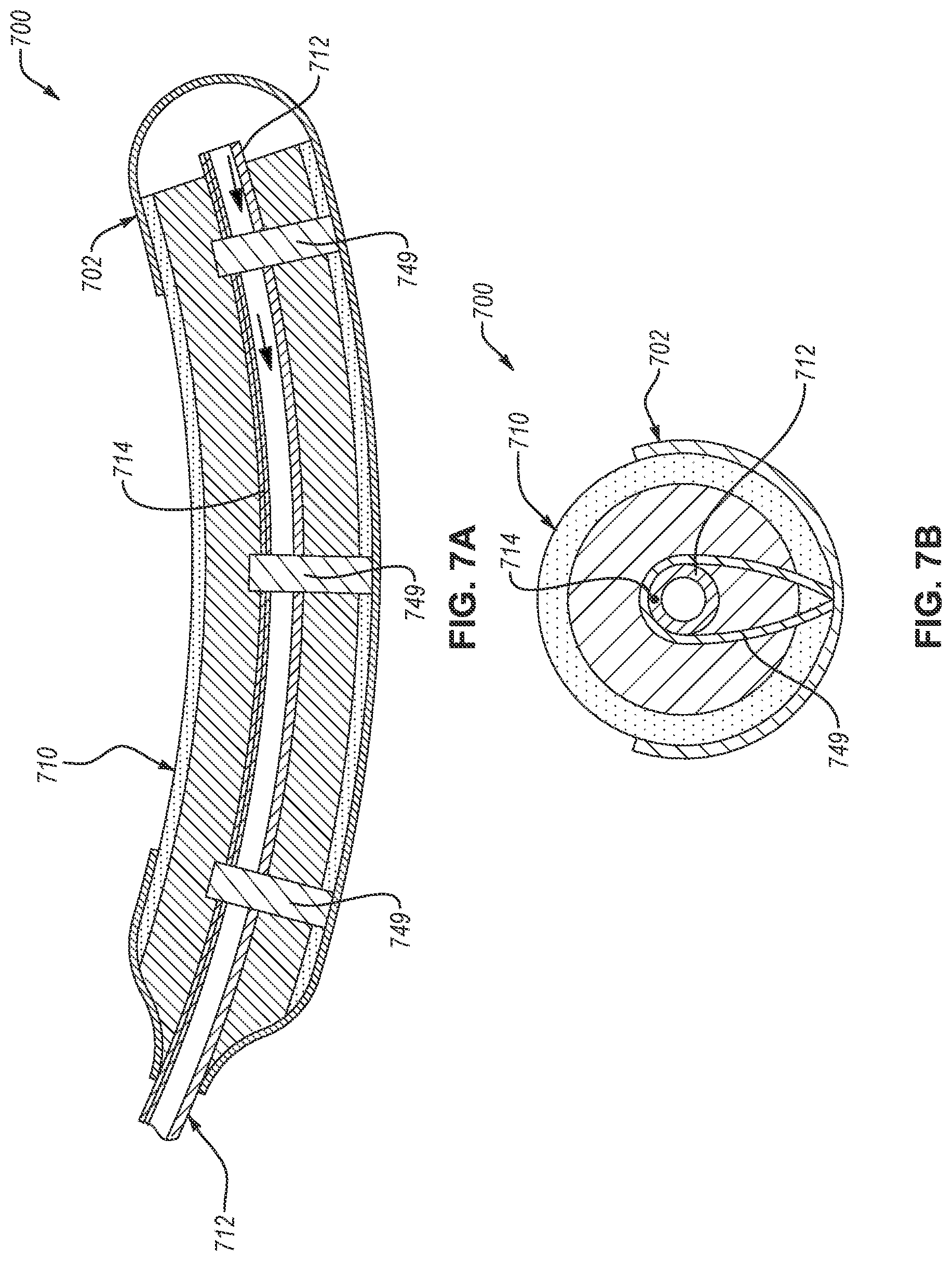 Patent US12569365 Figure 7 – Fluid collection assemblies including at least one shape memory material disposed in the conduit