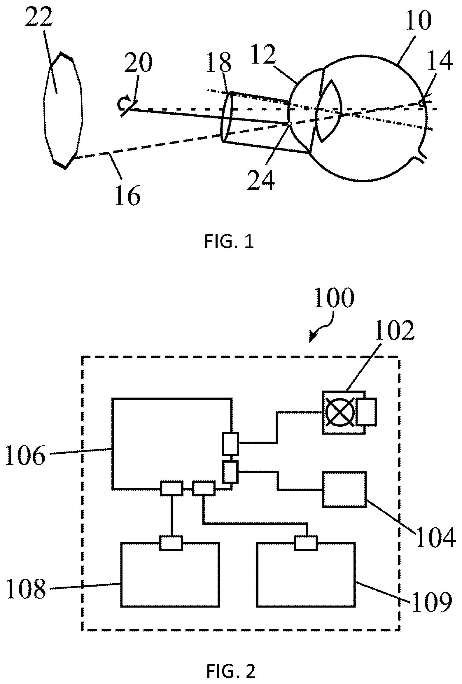 Patent US12569369 Figure 1 – System for laser-based ametropia correction, and method for the alignment thereof