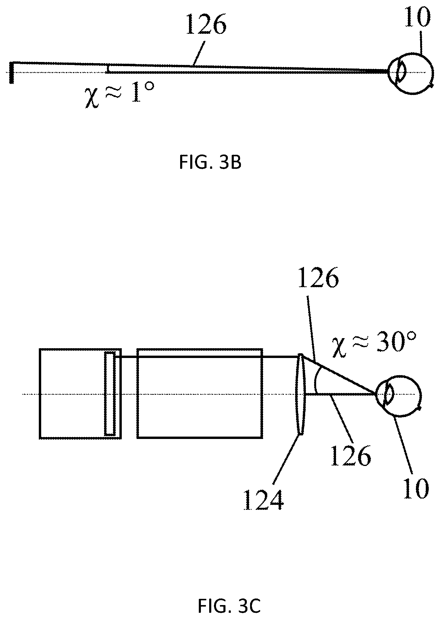 Patent US12569369 Figure 3 – System for laser-based ametropia correction, and method for the alignment thereof
