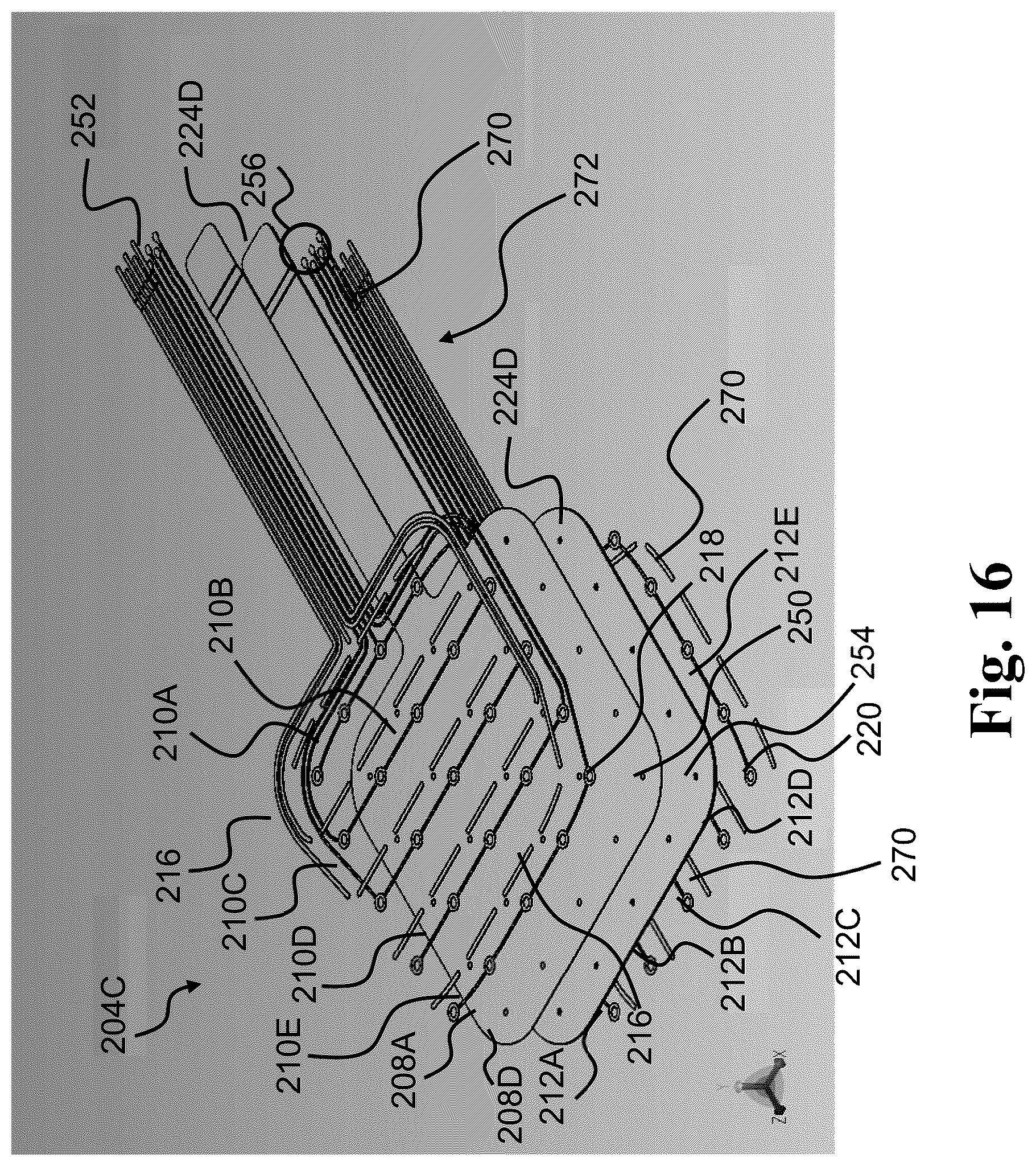 Patent US12569370 Figure 11 – Moisture sensing wound dressing