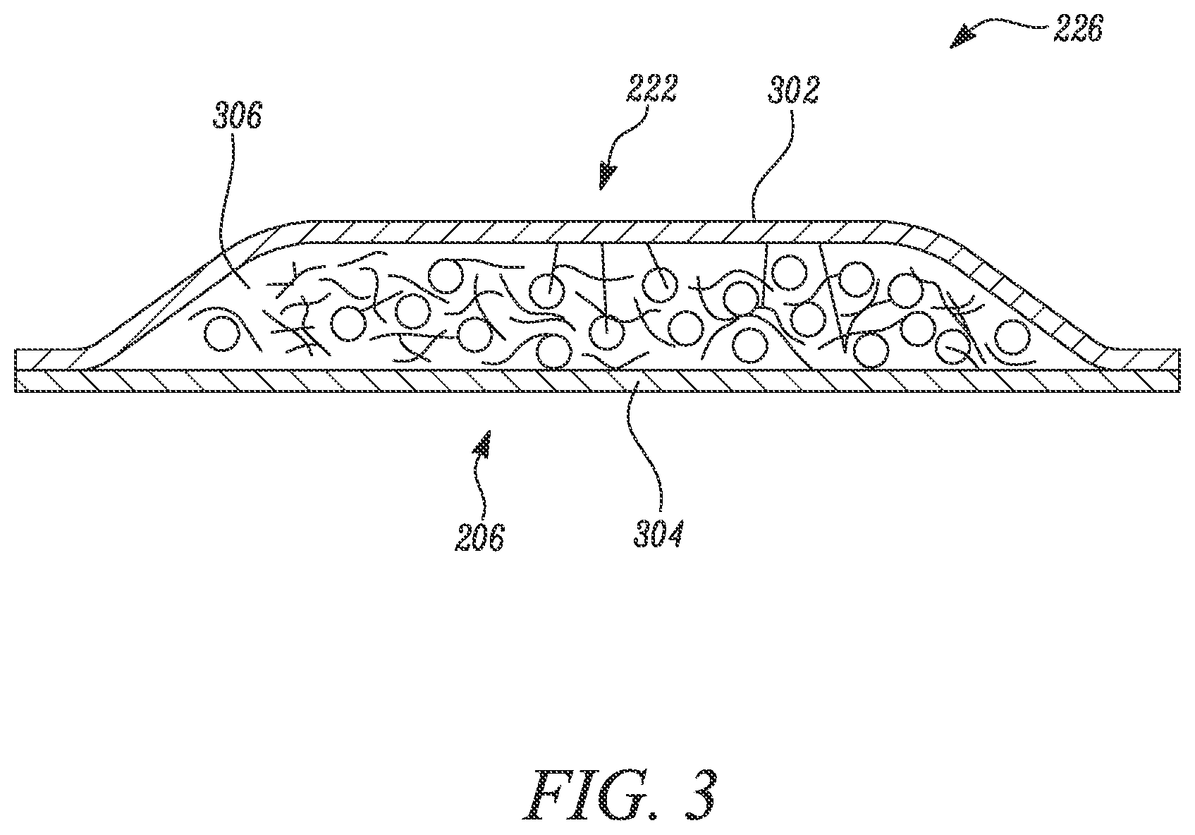 Patent US12569376 Figure 3 – Absorbent article with reusable belt and methods for manufacturing thereof