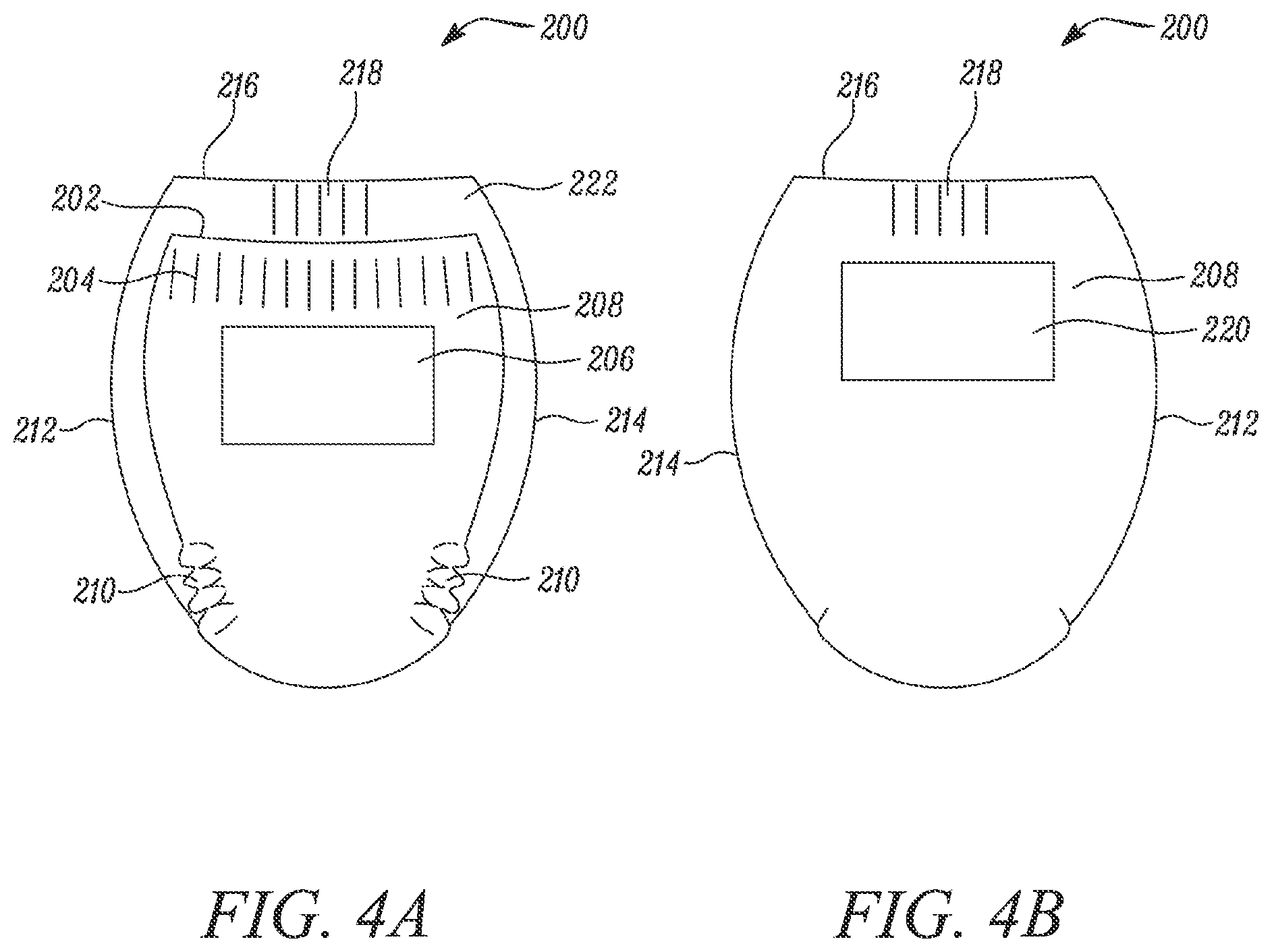 Patent US12569376 Figure 4 – Absorbent article with reusable belt and methods for manufacturing thereof