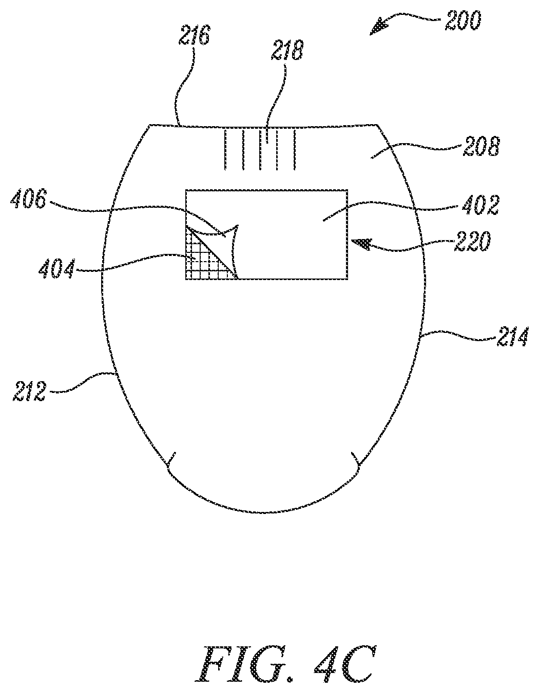 Patent US12569376 Figure 5 – Absorbent article with reusable belt and methods for manufacturing thereof