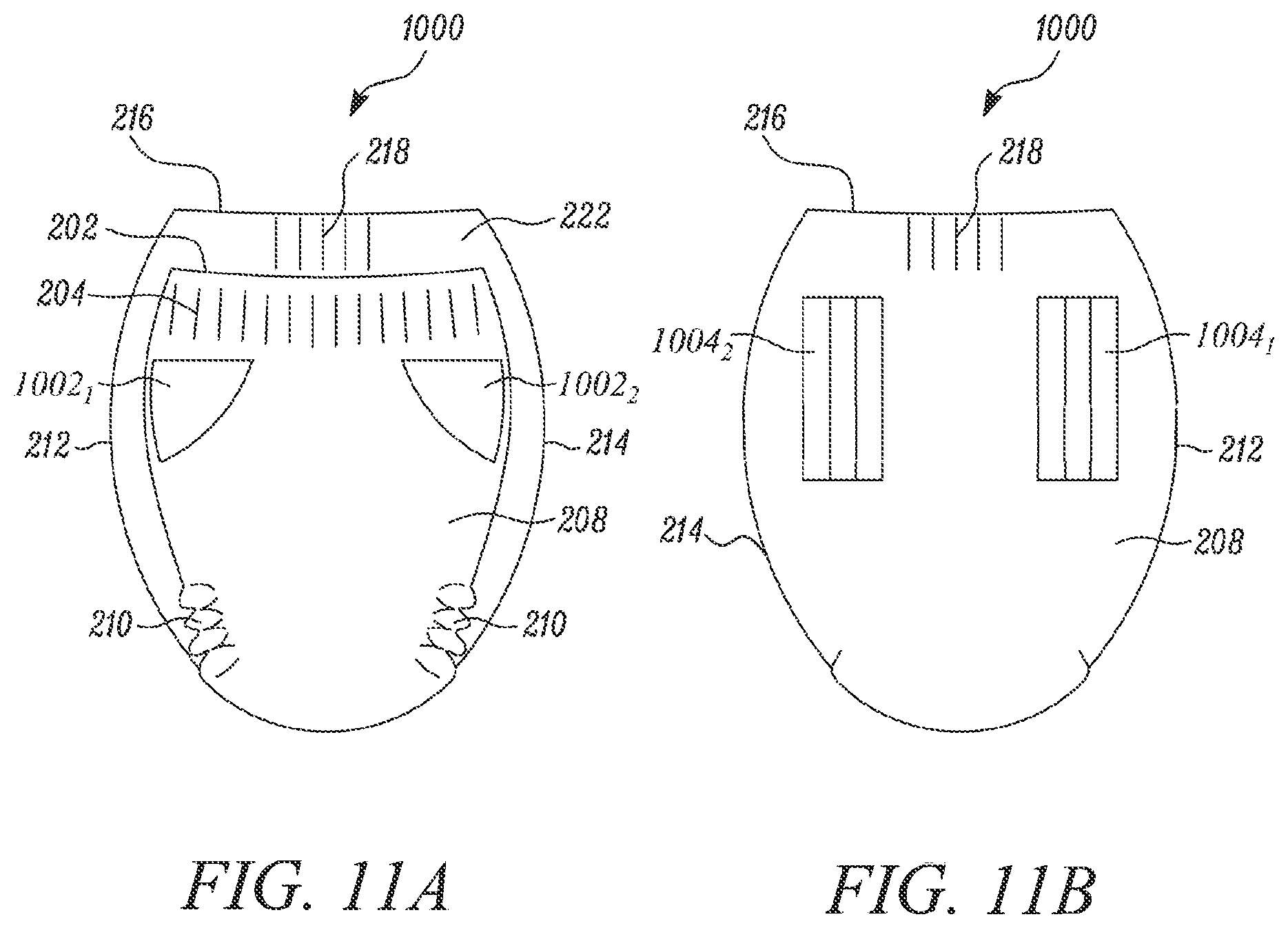 Patent US12569376 Figure 14 – Absorbent article with reusable belt and methods for manufacturing thereof
