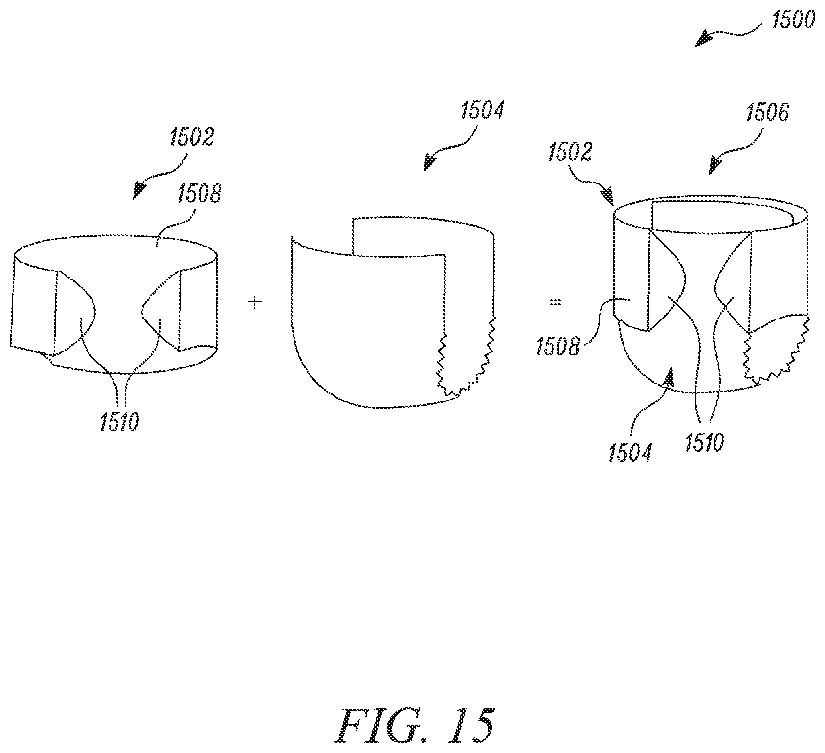 Patent US12569376 Figure 19 – Absorbent article with reusable belt and methods for manufacturing thereof