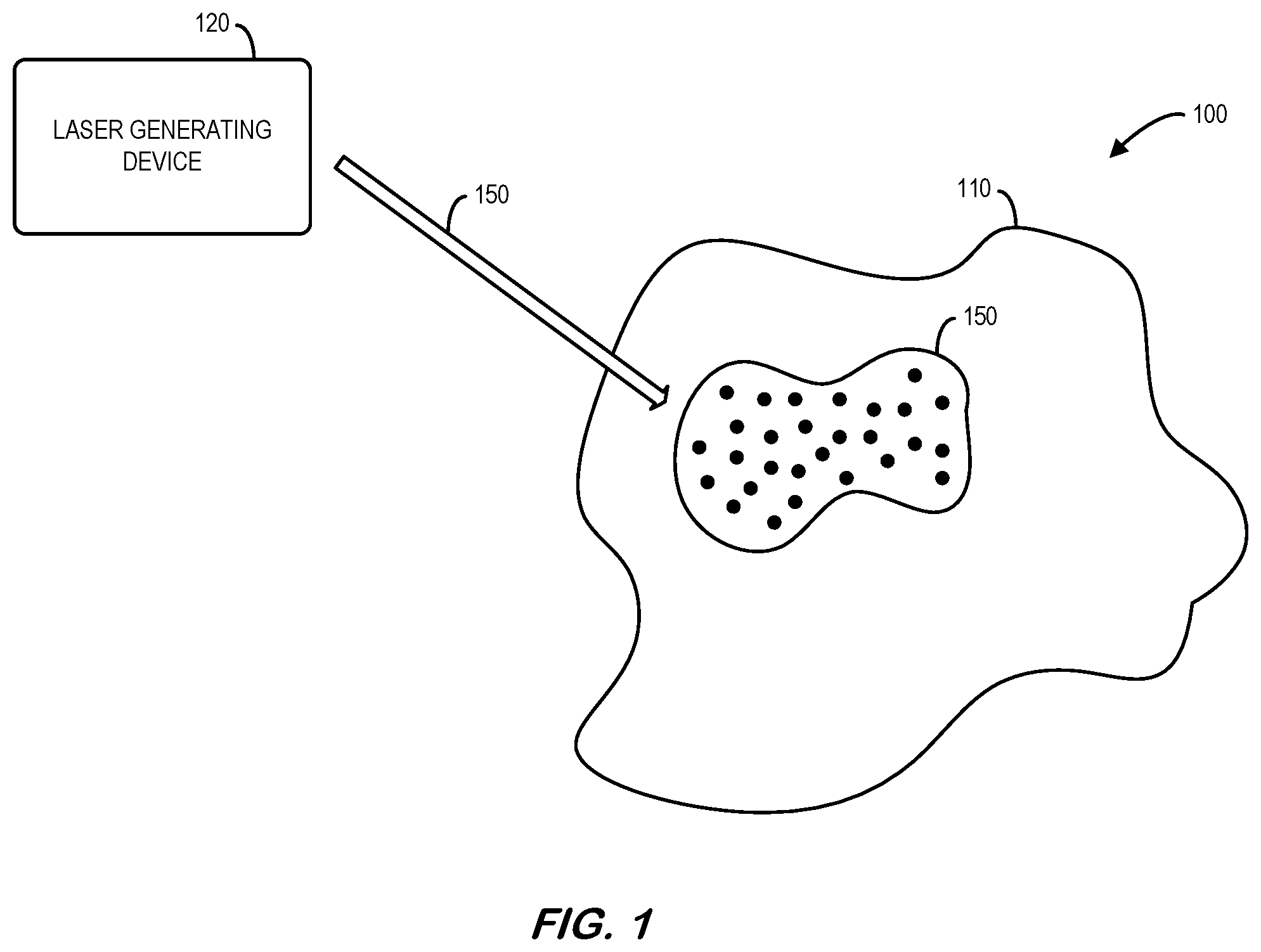 Patent US12569397 Figure 1 – Systems and methods for laser treatment of a dermatologic condition