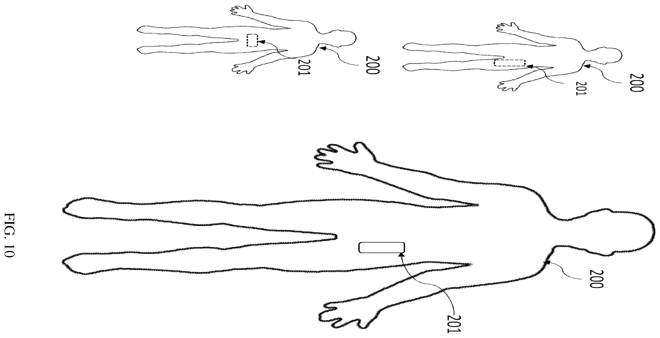 Patent US12569430 Figure 5 – Biodegradable implant including naltrexone