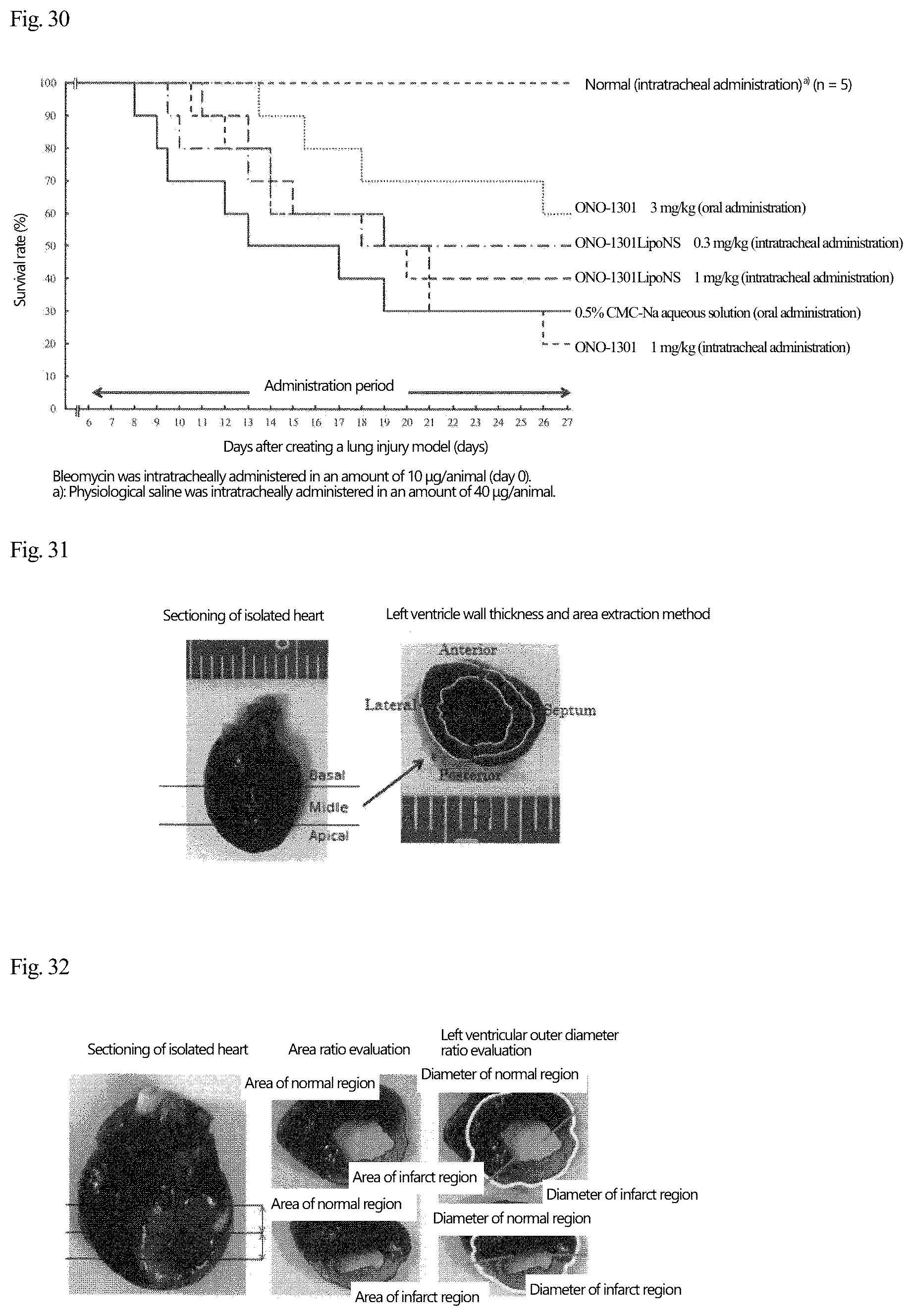 Patent US12569437 Figure 17 – Disease-site-specific liposomal formulation