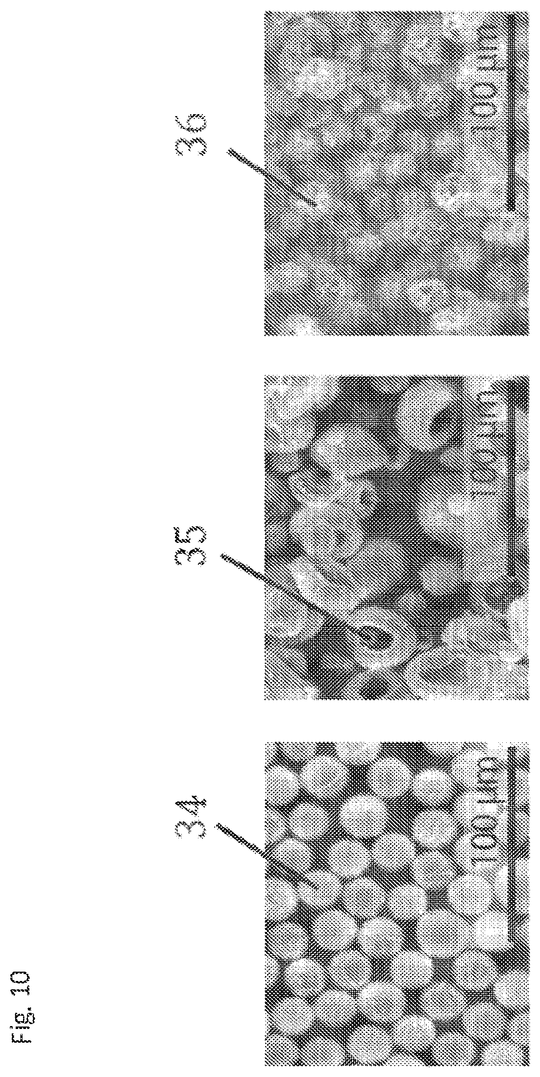 Patent US12569445 Figure 10 – Particles comprising a therapeutic or diagnostic agent and suspensions and methods of use thereof